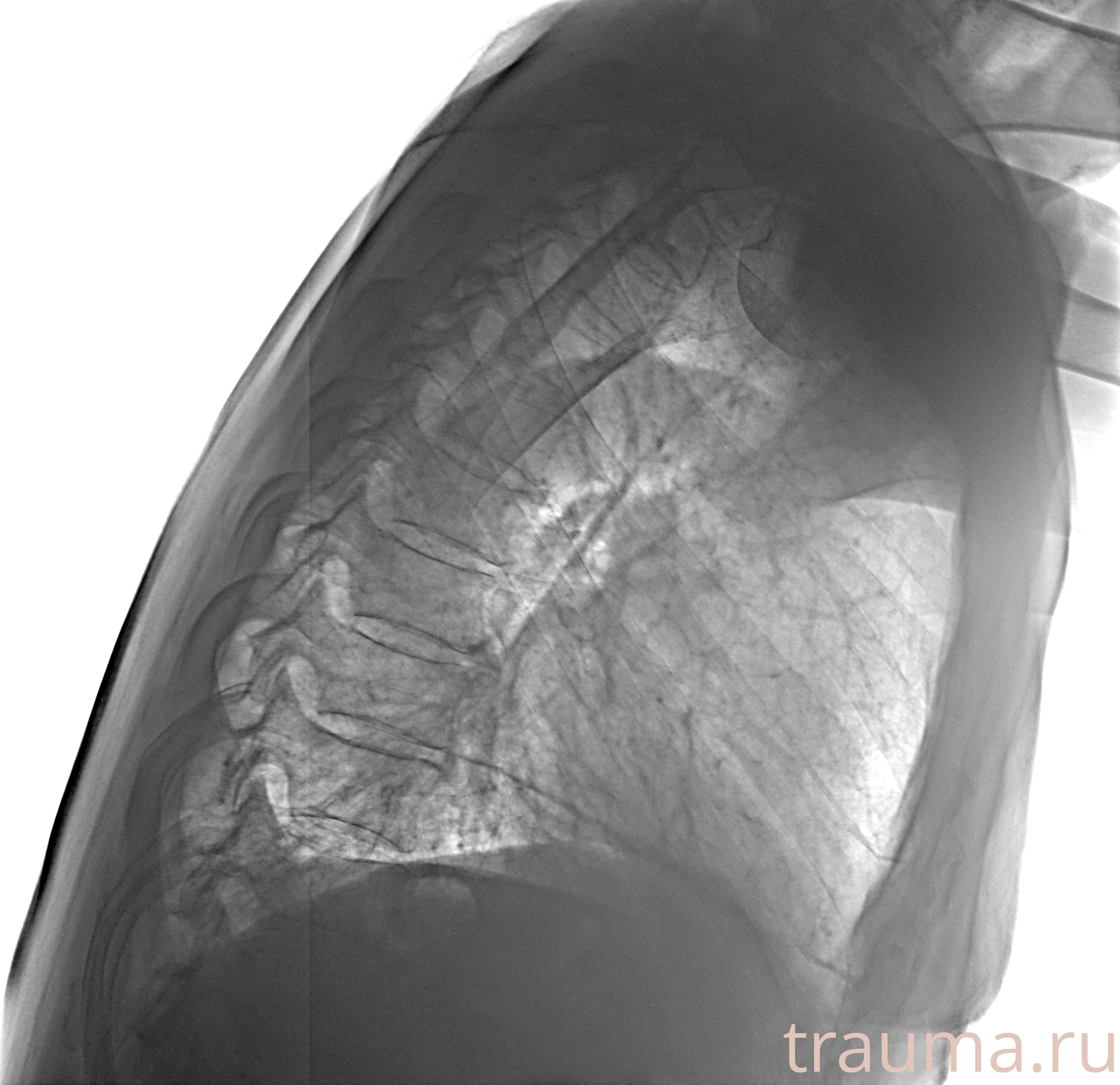 Рентген на дому: по вашему адресу приезжает врач-рентгенолог, травматолог-ортопед с мобильным рентгеновским аппаратом, проводит диагностику травмы или заболевания, делает необходимые рентгенограммы, дает рекомендации по дальнейшему лечению. Получить качественные снимки в домашних условиях возможно благодаря уникальной методике, разработанной МосРентген Центром для института  Склифосовского