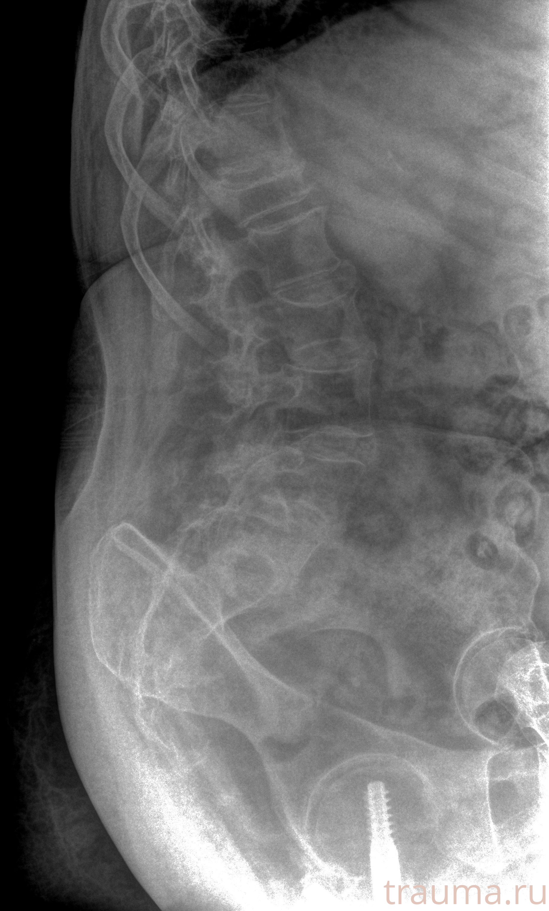 Рентген на дому: по вашему адресу приезжает врач-рентгенолог, травматолог-ортопед с мобильным рентгеновским аппаратом, проводит диагностику травмы или заболевания, делает необходимые рентгенограммы, дает рекомендации по дальнейшему лечению. Получить качественные снимки в домашних условиях возможно благодаря уникальной методике, разработанной МосРентген Центром для института  Склифосовского