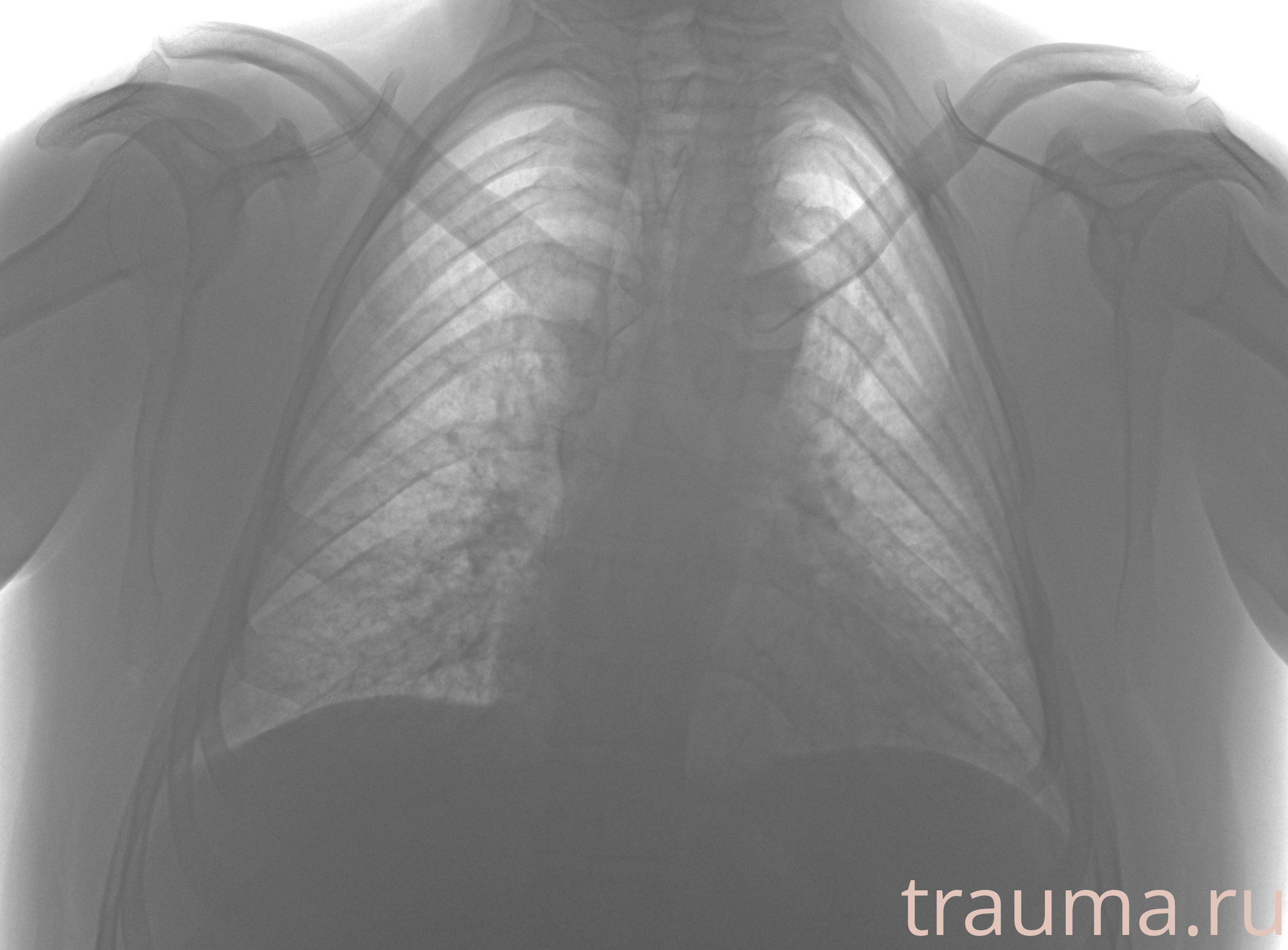 Рентген на дому: по вашему адресу приезжает врач-рентгенолог, травматолог-ортопед с мобильным рентгеновским аппаратом, проводит диагностику травмы или заболевания, делает необходимые рентгенограммы, дает рекомендации по дальнейшему лечению. Получить качественные снимки в домашних условиях возможно благодаря уникальной методике, разработанной МосРентген Центром для института  Склифосовского