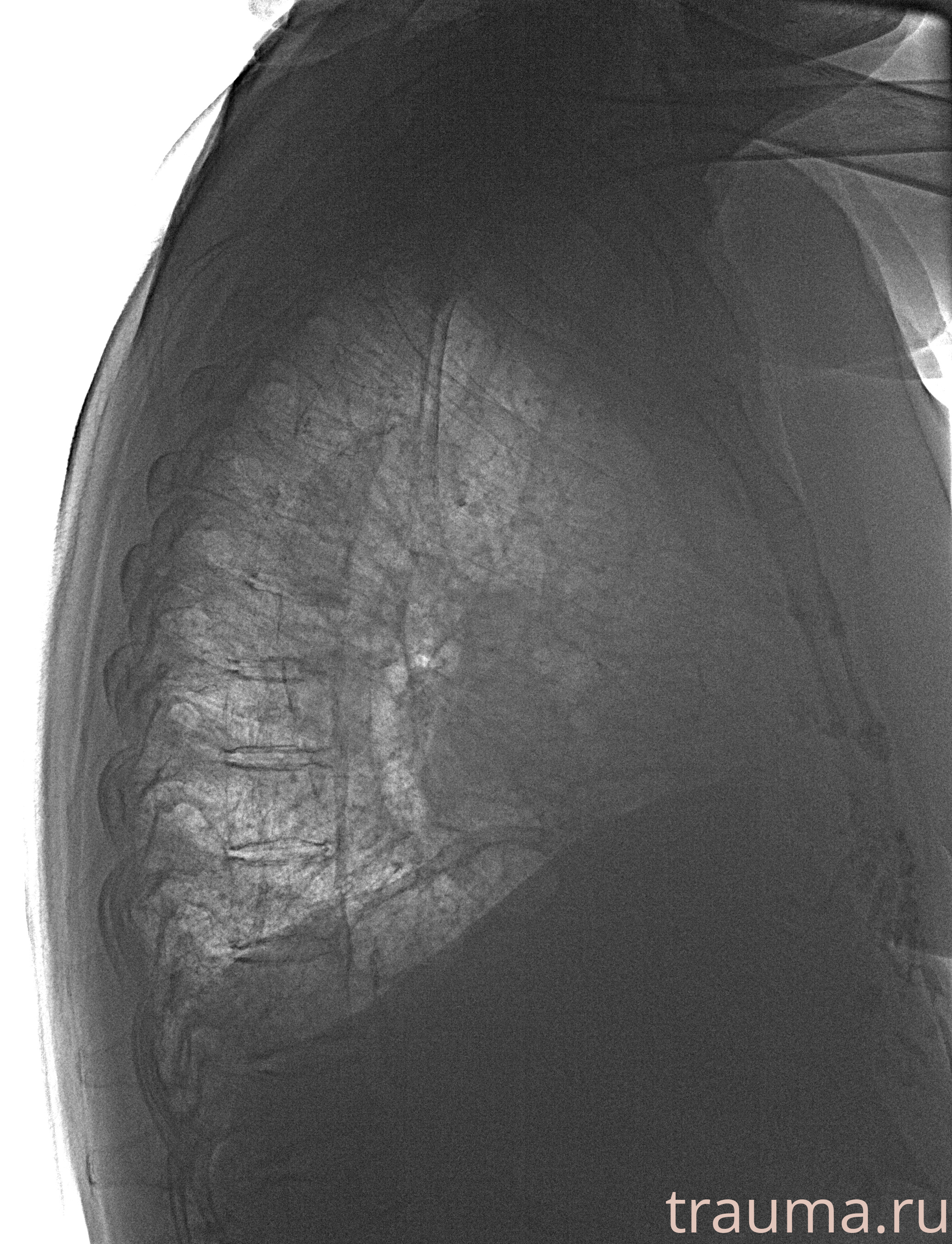 Рентген на дому: по вашему адресу приезжает врач-рентгенолог, травматолог-ортопед с мобильным рентгеновским аппаратом, проводит диагностику травмы или заболевания, делает необходимые рентгенограммы, дает рекомендации по дальнейшему лечению. Получить качественные снимки в домашних условиях возможно благодаря уникальной методике, разработанной МосРентген Центром для института  Склифосовского