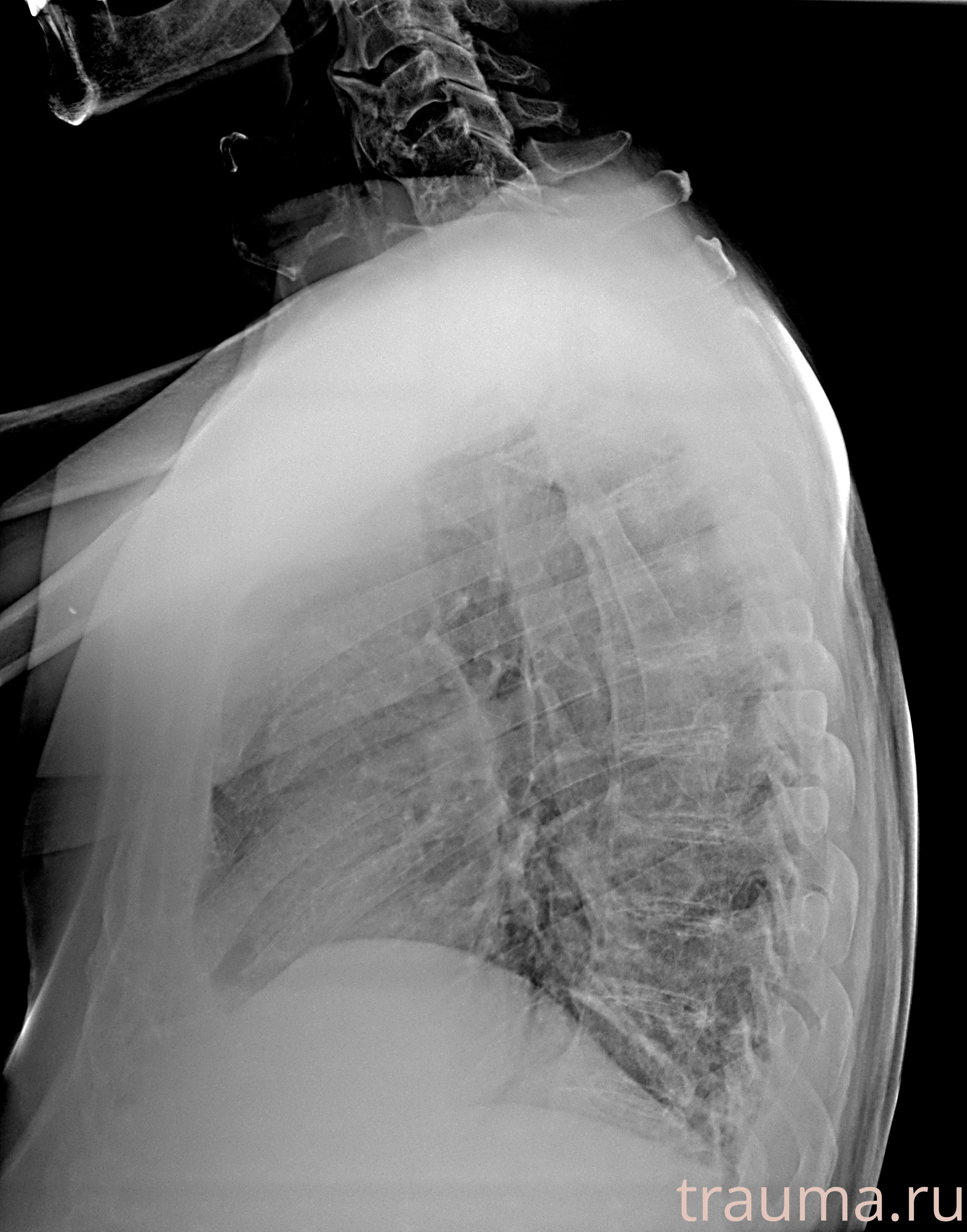 Рентген на дому: по вашему адресу приезжает врач-рентгенолог, травматолог-ортопед с мобильным рентгеновским аппаратом, проводит диагностику травмы или заболевания, делает необходимые рентгенограммы, дает рекомендации по дальнейшему лечению. Получить качественные снимки в домашних условиях возможно благодаря уникальной методике, разработанной МосРентген Центром для института  Склифосовского