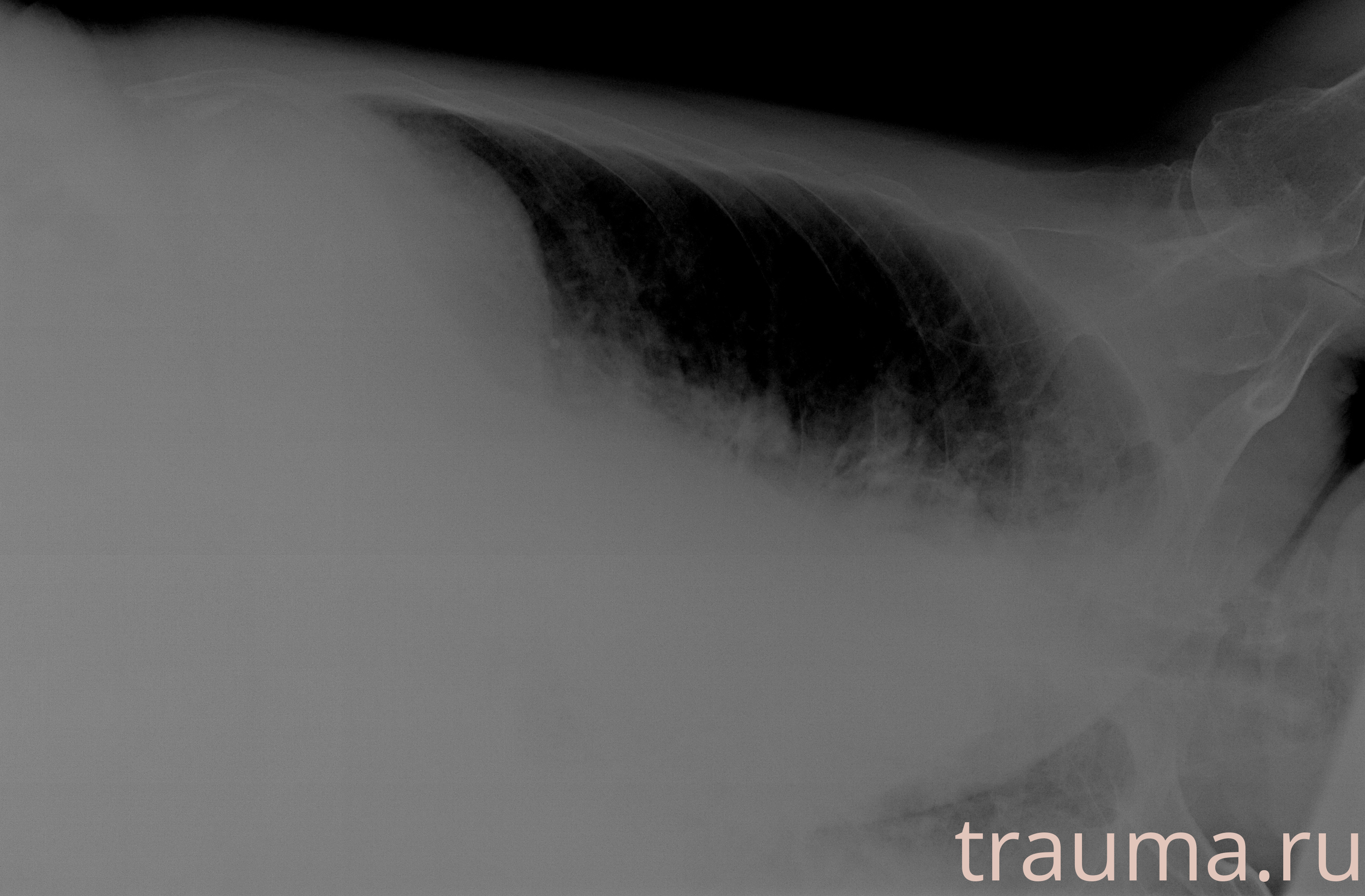 Рентген на дому: по вашему адресу приезжает врач-рентгенолог, травматолог-ортопед с мобильным рентгеновским аппаратом, проводит диагностику травмы или заболевания, делает необходимые рентгенограммы, дает рекомендации по дальнейшему лечению. Получить качественные снимки в домашних условиях возможно благодаря уникальной методике, разработанной МосРентген Центром для института  Склифосовского