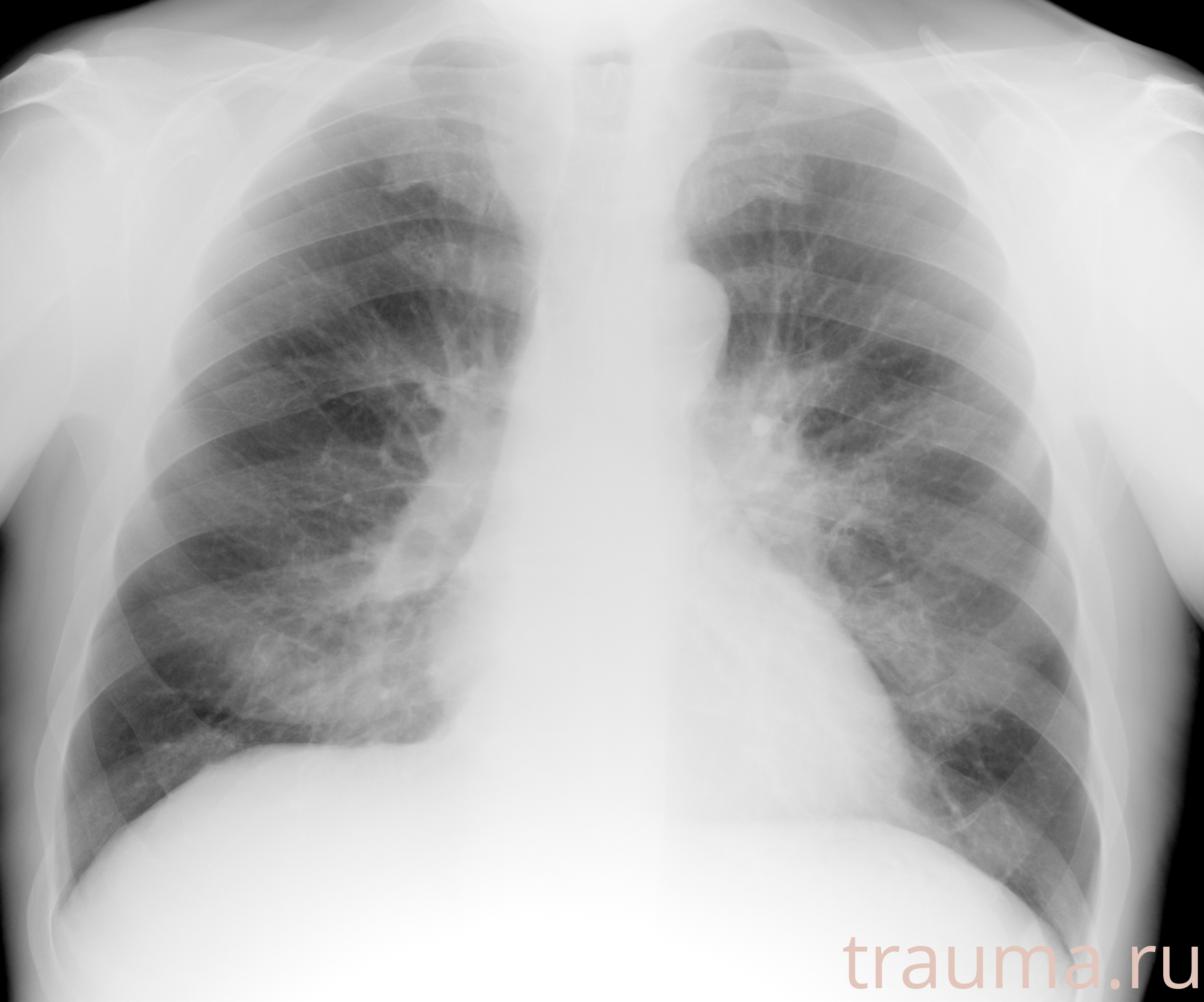 Рентген на дому: по вашему адресу приезжает врач-рентгенолог, травматолог-ортопед с мобильным рентгеновским аппаратом, проводит диагностику травмы или заболевания, делает необходимые рентгенограммы, дает рекомендации по дальнейшему лечению. Получить качественные снимки в домашних условиях возможно благодаря уникальной методике, разработанной МосРентген Центром для института  Склифосовского