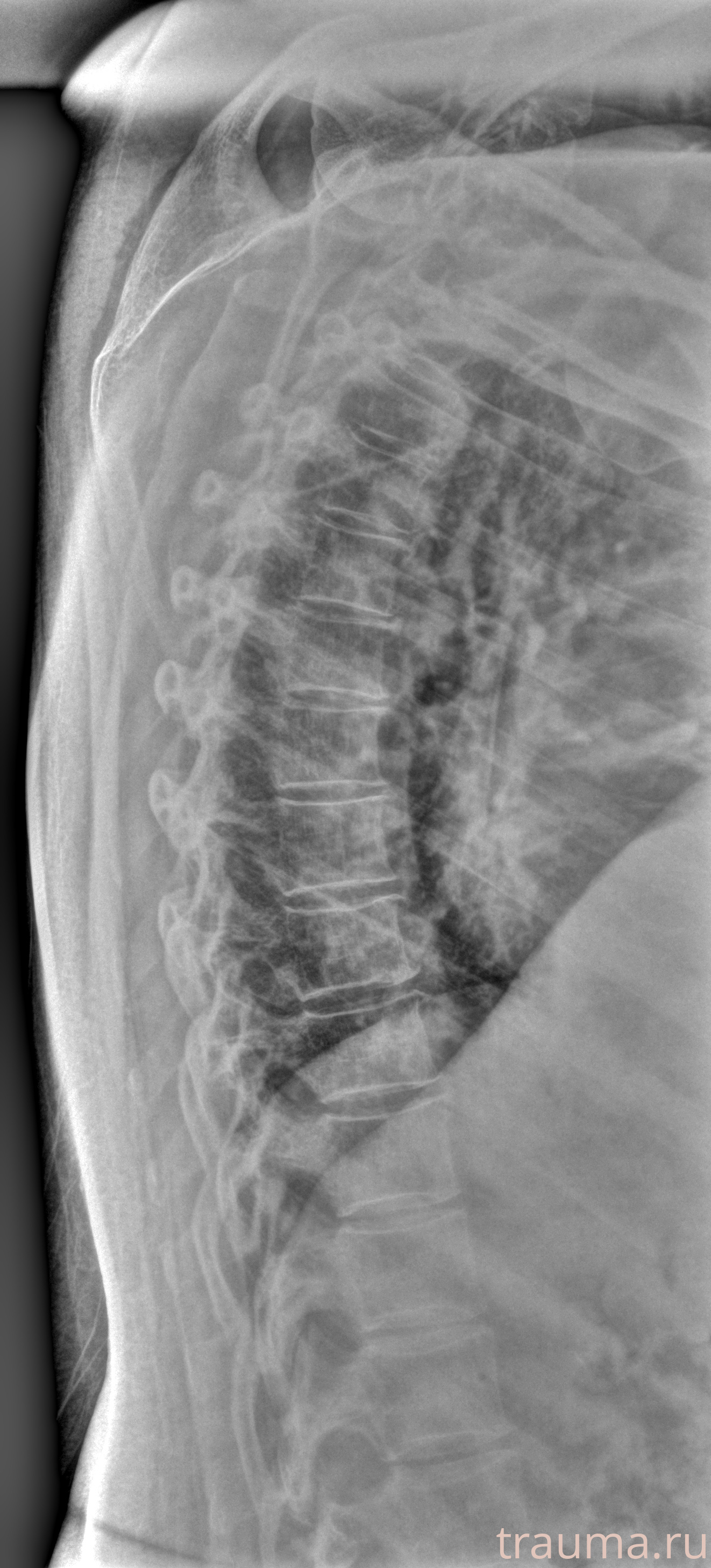 Рентген на дому: по вашему адресу приезжает врач-рентгенолог, травматолог-ортопед с мобильным рентгеновским аппаратом, проводит диагностику травмы или заболевания, делает необходимые рентгенограммы, дает рекомендации по дальнейшему лечению. Получить качественные снимки в домашних условиях возможно благодаря уникальной методике, разработанной МосРентген Центром для института  Склифосовского