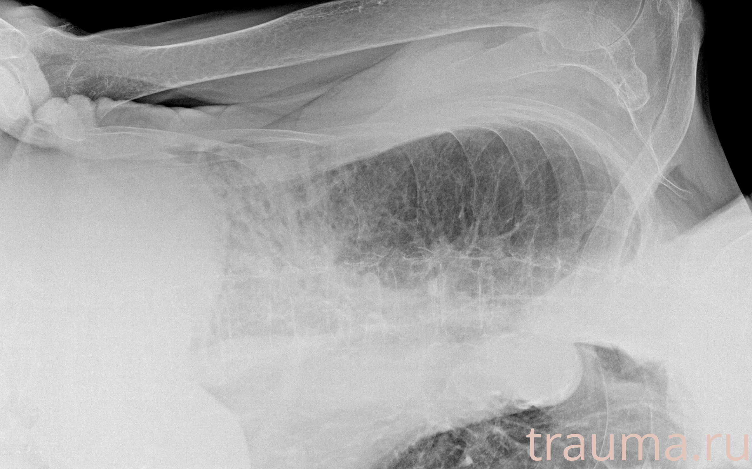 Рентген на дому: по вашему адресу приезжает врач-рентгенолог, травматолог-ортопед с мобильным рентгеновским аппаратом, проводит диагностику травмы или заболевания, делает необходимые рентгенограммы, дает рекомендации по дальнейшему лечению. Получить качественные снимки в домашних условиях возможно благодаря уникальной методике, разработанной МосРентген Центром для института  Склифосовского