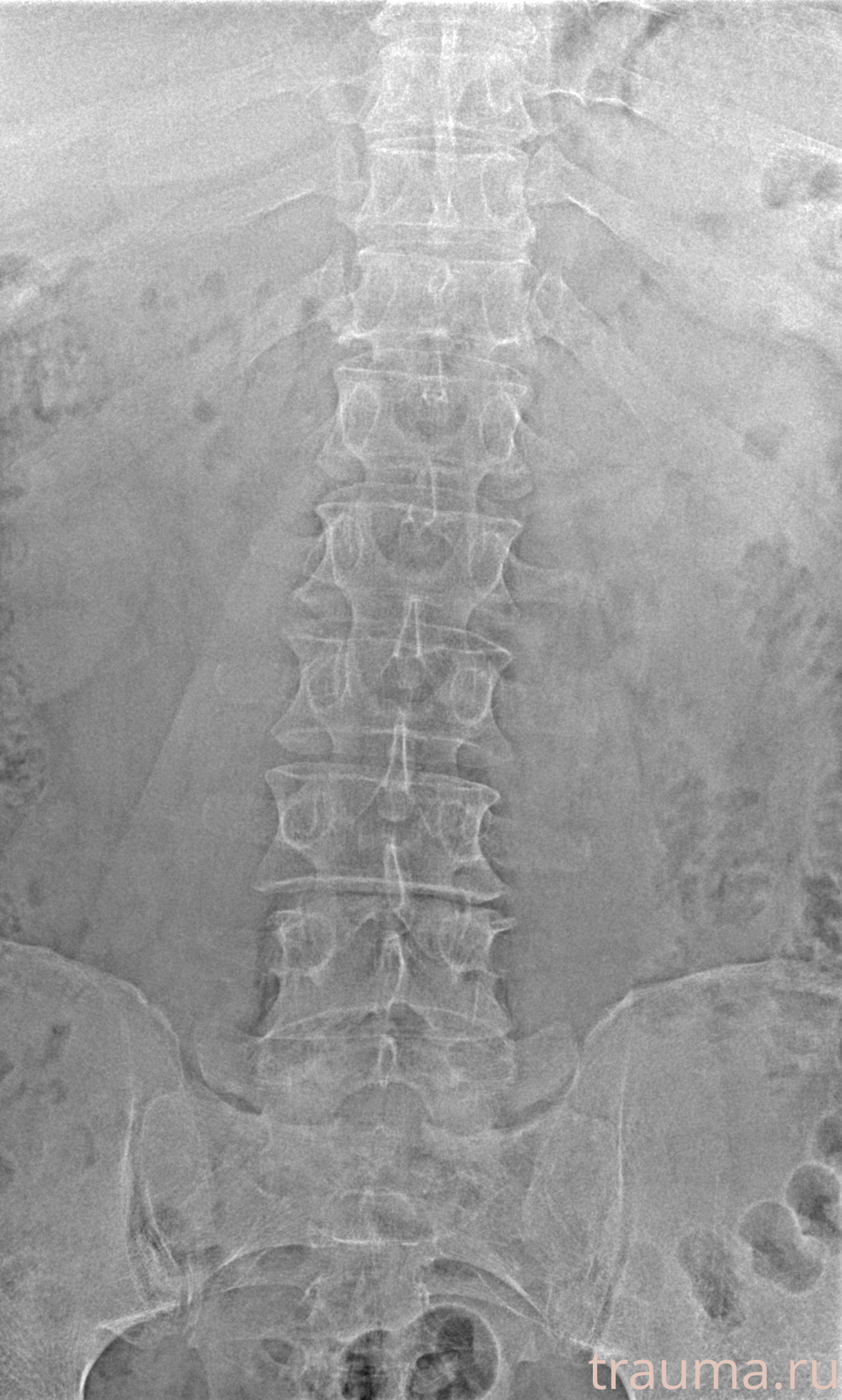 Рентген на дому: по вашему адресу приезжает врач-рентгенолог, травматолог-ортопед с мобильным рентгеновским аппаратом, проводит диагностику травмы или заболевания, делает необходимые рентгенограммы, дает рекомендации по дальнейшему лечению. Получить качественные снимки в домашних условиях возможно благодаря уникальной методике, разработанной МосРентген Центром для института  Склифосовского