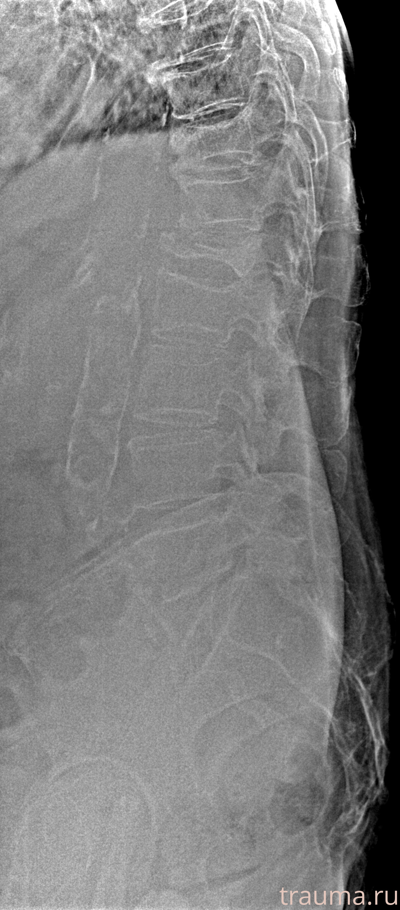Рентген на дому: по вашему адресу приезжает врач-рентгенолог, травматолог-ортопед с мобильным рентгеновским аппаратом, проводит диагностику травмы или заболевания, делает необходимые рентгенограммы, дает рекомендации по дальнейшему лечению. Получить качественные снимки в домашних условиях возможно благодаря уникальной методике, разработанной МосРентген Центром для института  Склифосовского