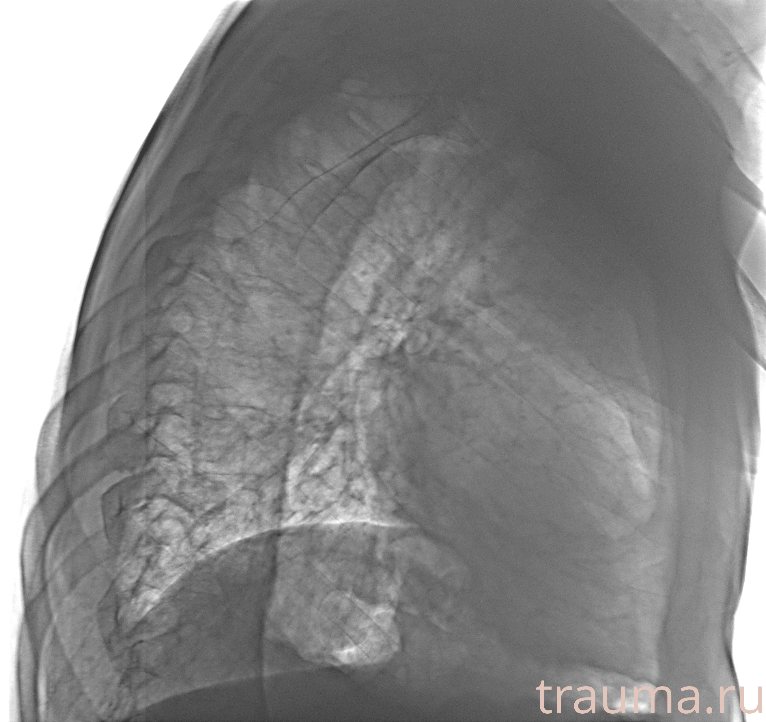 Рентген на дому: по вашему адресу приезжает врач-рентгенолог, травматолог-ортопед с мобильным рентгеновским аппаратом, проводит диагностику травмы или заболевания, делает необходимые рентгенограммы, дает рекомендации по дальнейшему лечению. Получить качественные снимки в домашних условиях возможно благодаря уникальной методике, разработанной МосРентген Центром для института  Склифосовского