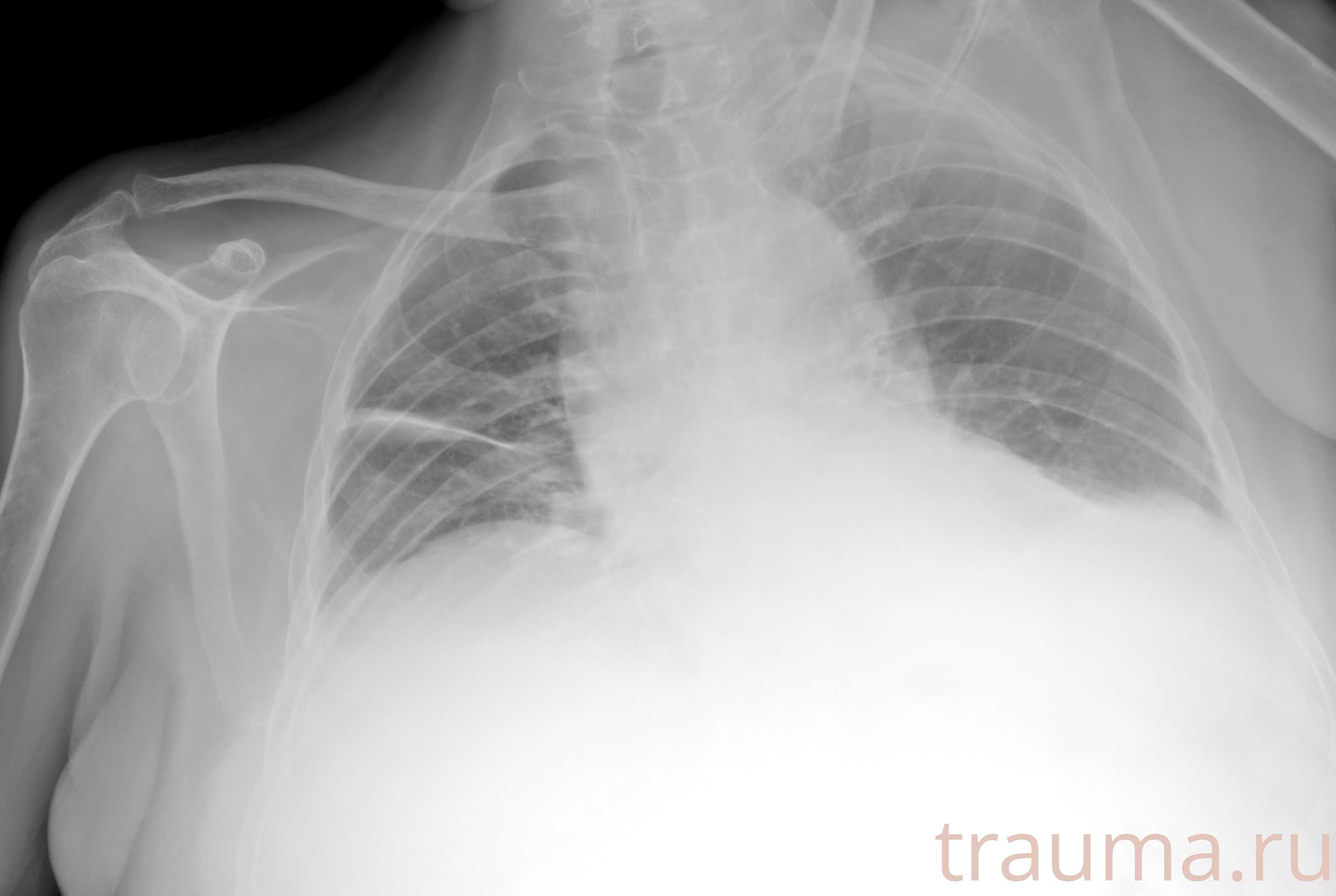 Рентген на дому: по вашему адресу приезжает врач-рентгенолог, травматолог-ортопед с мобильным рентгеновским аппаратом, проводит диагностику травмы или заболевания, делает необходимые рентгенограммы, дает рекомендации по дальнейшему лечению. Получить качественные снимки в домашних условиях возможно благодаря уникальной методике, разработанной МосРентген Центром для института  Склифосовского