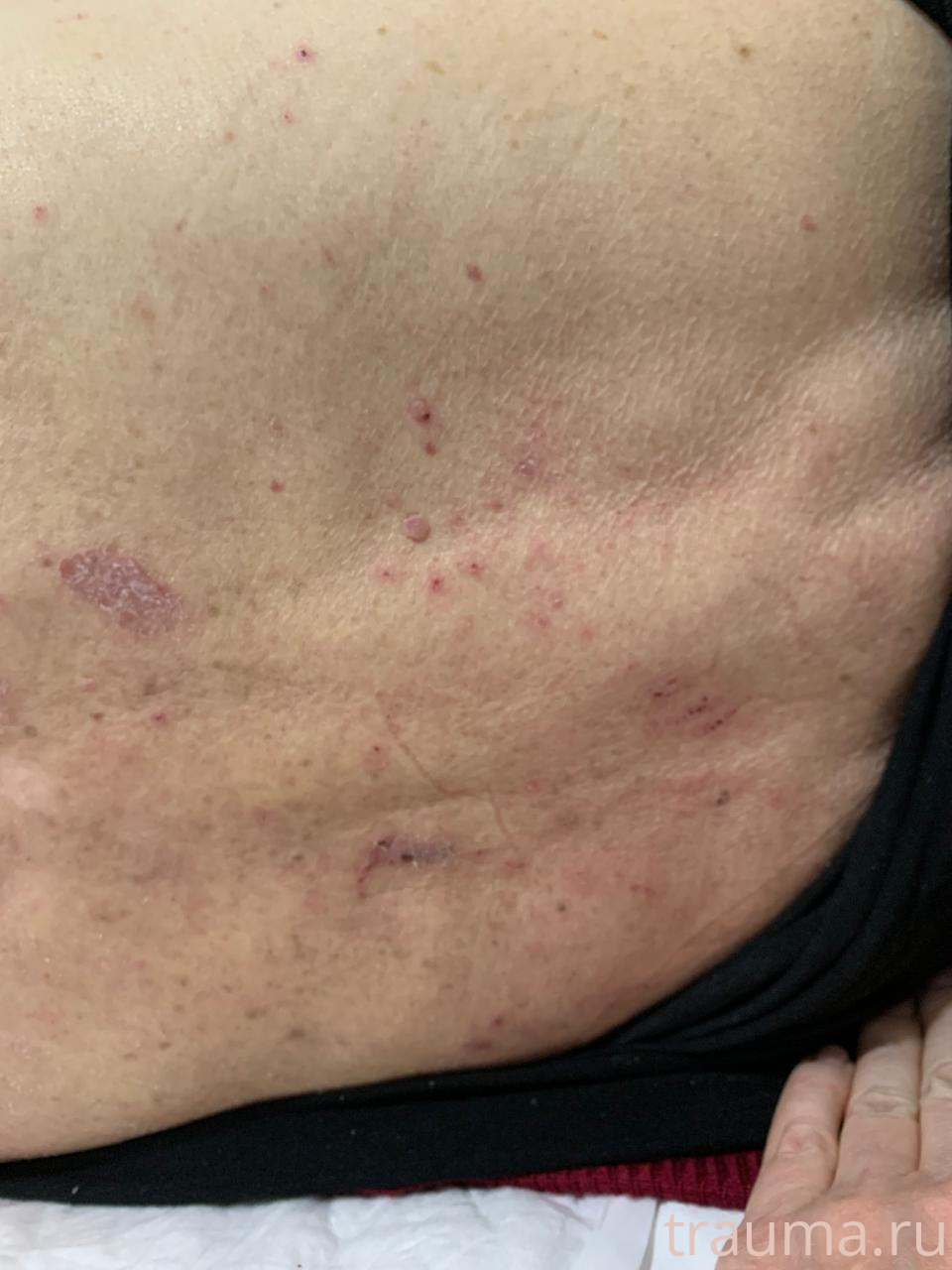 Рентген на дому: по вашему адресу приезжает врач-рентгенолог, травматолог-ортопед с мобильным рентгеновским аппаратом, проводит диагностику травмы или заболевания, делает необходимые рентгенограммы, дает рекомендации по дальнейшему лечению. Получить качественные снимки в домашних условиях возможно благодаря уникальной методике, разработанной МосРентген Центром для института  Склифосовского