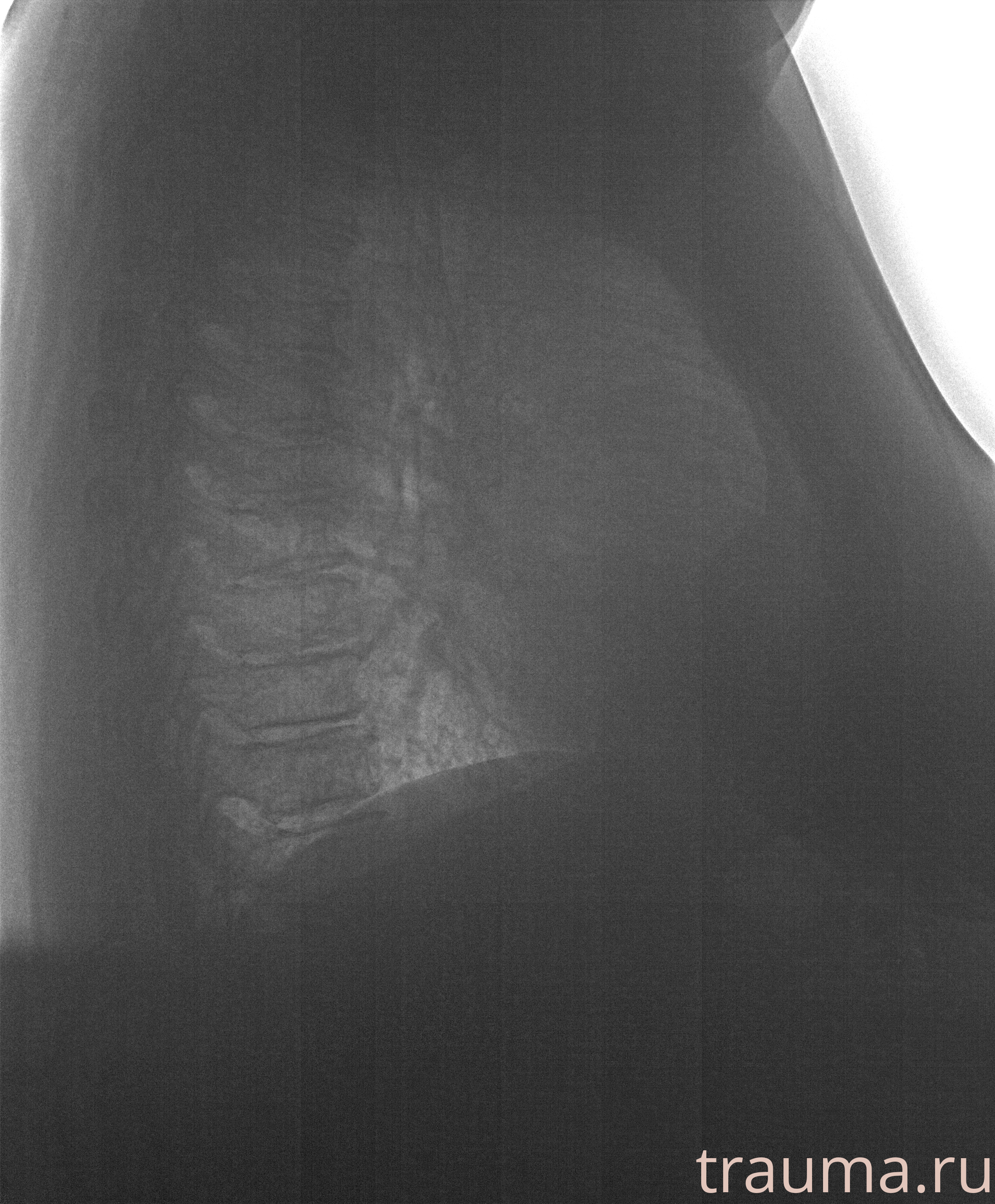 Рентген на дому: по вашему адресу приезжает врач-рентгенолог, травматолог-ортопед с мобильным рентгеновским аппаратом, проводит диагностику травмы или заболевания, делает необходимые рентгенограммы, дает рекомендации по дальнейшему лечению. Получить качественные снимки в домашних условиях возможно благодаря уникальной методике, разработанной МосРентген Центром для института  Склифосовского