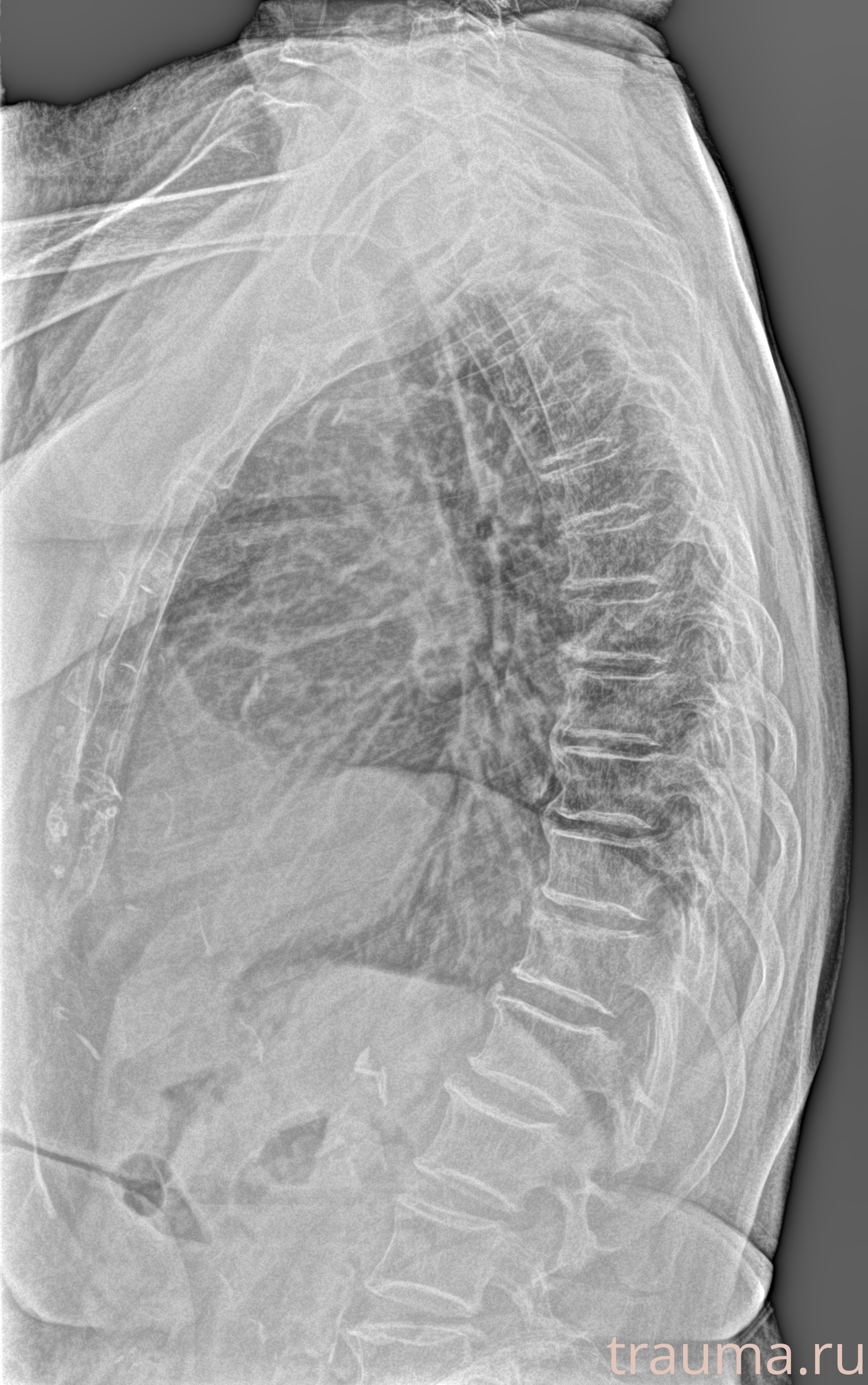 Рентген на дому: по вашему адресу приезжает врач-рентгенолог, травматолог-ортопед с мобильным рентгеновским аппаратом, проводит диагностику травмы или заболевания, делает необходимые рентгенограммы, дает рекомендации по дальнейшему лечению. Получить качественные снимки в домашних условиях возможно благодаря уникальной методике, разработанной МосРентген Центром для института  Склифосовского