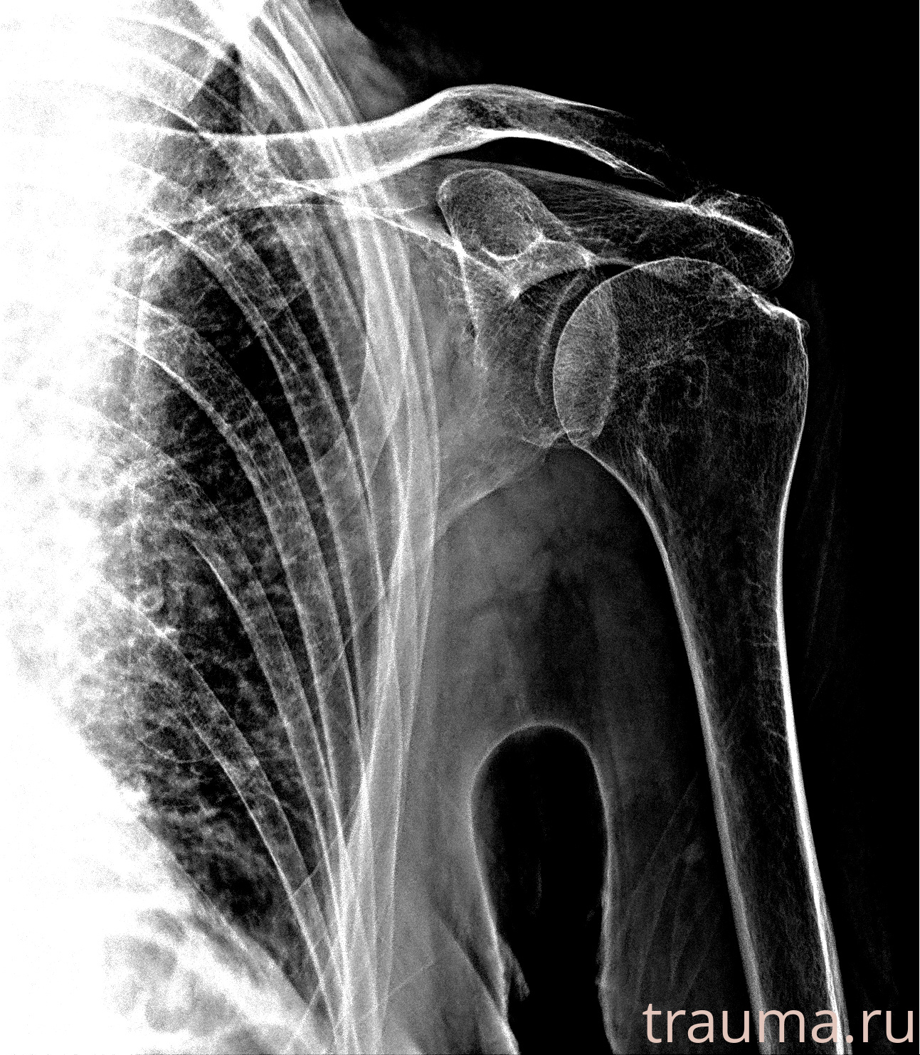 Рентген на дому: по вашему адресу приезжает врач-рентгенолог, травматолог-ортопед с мобильным рентгеновским аппаратом, проводит диагностику травмы или заболевания, делает необходимые рентгенограммы, дает рекомендации по дальнейшему лечению. Получить качественные снимки в домашних условиях возможно благодаря уникальной методике, разработанной МосРентген Центром для института  Склифосовского