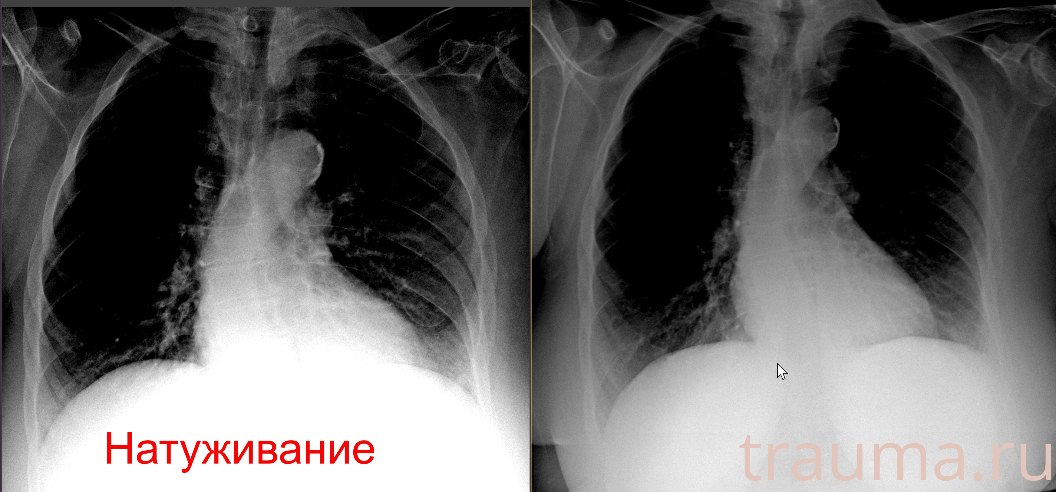 Рентген на дому: по вашему адресу приезжает врач-рентгенолог, травматолог-ортопед с мобильным рентгеновским аппаратом, проводит диагностику травмы или заболевания, делает необходимые рентгенограммы, дает рекомендации по дальнейшему лечению. Получить качественные снимки в домашних условиях возможно благодаря уникальной методике, разработанной МосРентген Центром для института  Склифосовского