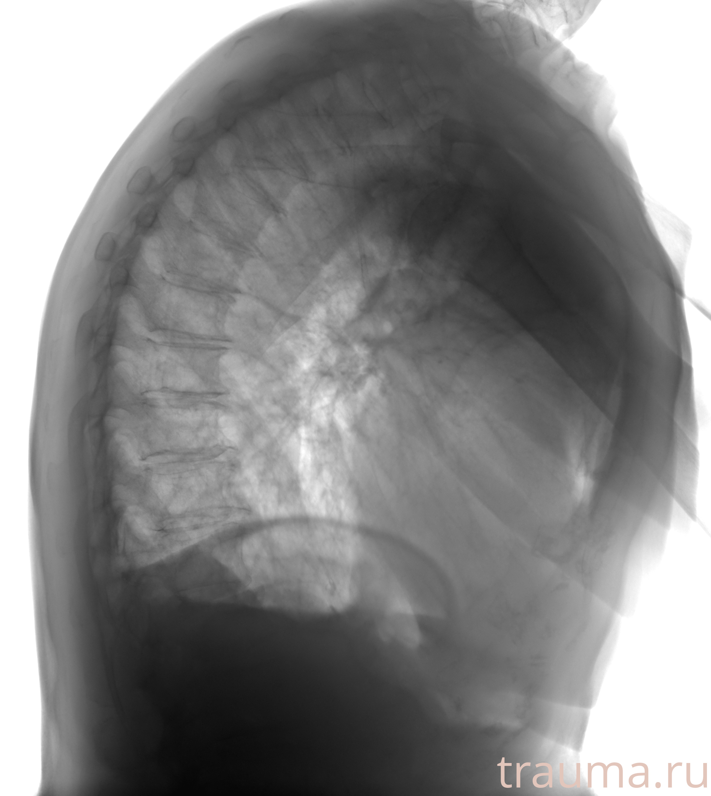 Рентген на дому: по вашему адресу приезжает врач-рентгенолог, травматолог-ортопед с мобильным рентгеновским аппаратом, проводит диагностику травмы или заболевания, делает необходимые рентгенограммы, дает рекомендации по дальнейшему лечению. Получить качественные снимки в домашних условиях возможно благодаря уникальной методике, разработанной МосРентген Центром для института  Склифосовского