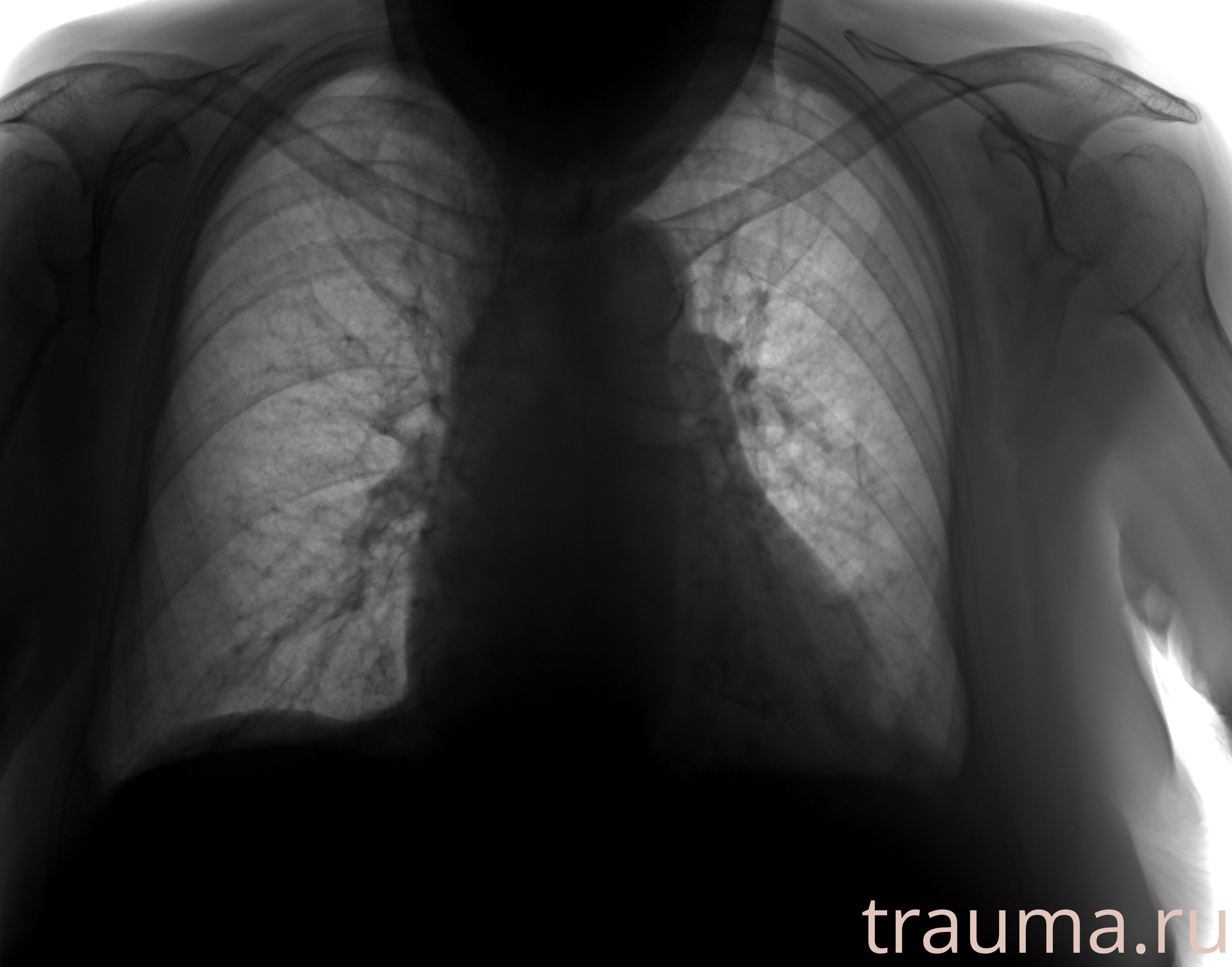 Рентген на дому: по вашему адресу приезжает врач-рентгенолог, травматолог-ортопед с мобильным рентгеновским аппаратом, проводит диагностику травмы или заболевания, делает необходимые рентгенограммы, дает рекомендации по дальнейшему лечению. Получить качественные снимки в домашних условиях возможно благодаря уникальной методике, разработанной МосРентген Центром для института  Склифосовского