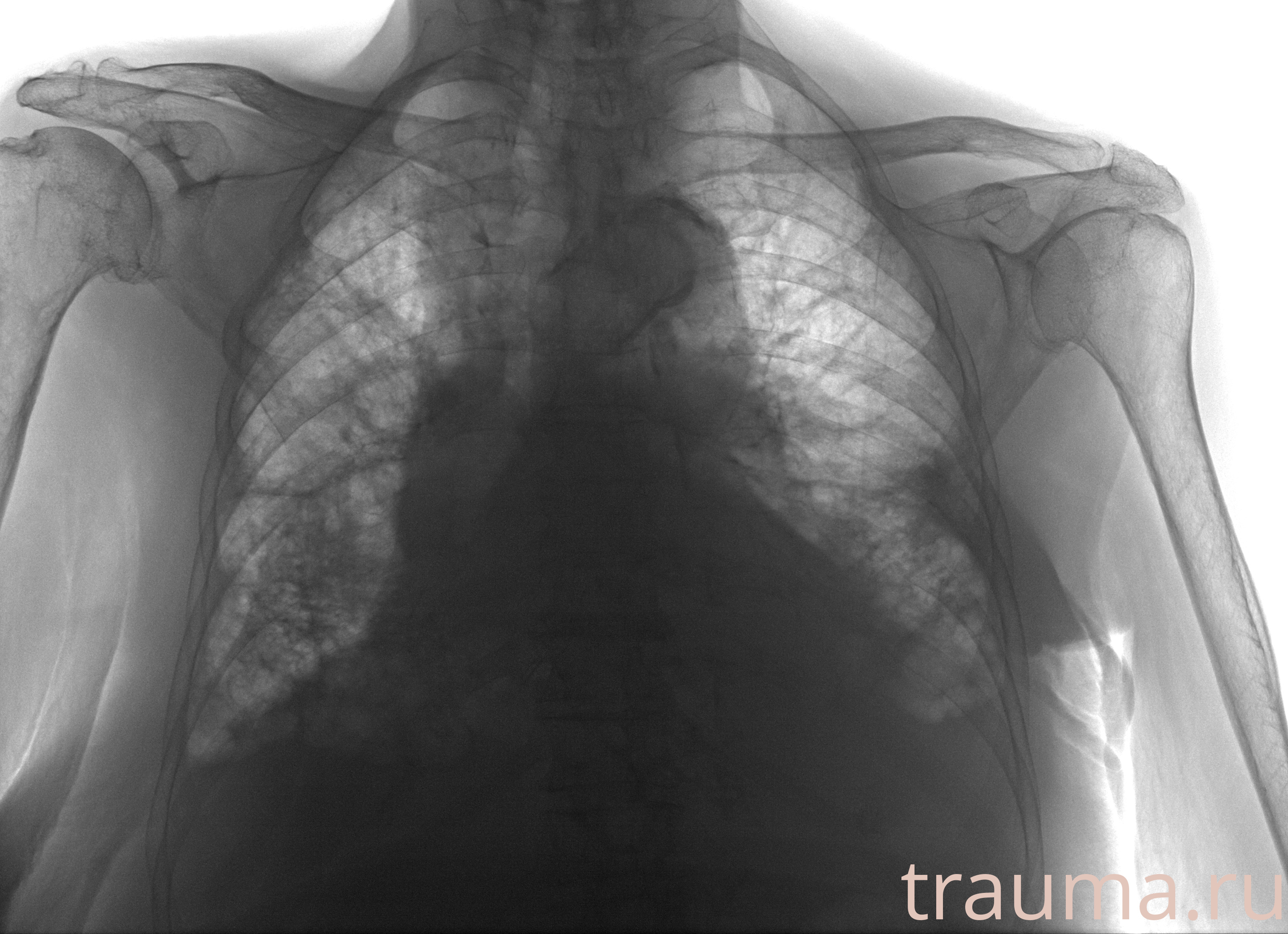 Рентген на дому: по вашему адресу приезжает врач-рентгенолог, травматолог-ортопед с мобильным рентгеновским аппаратом, проводит диагностику травмы или заболевания, делает необходимые рентгенограммы, дает рекомендации по дальнейшему лечению. Получить качественные снимки в домашних условиях возможно благодаря уникальной методике, разработанной МосРентген Центром для института  Склифосовского