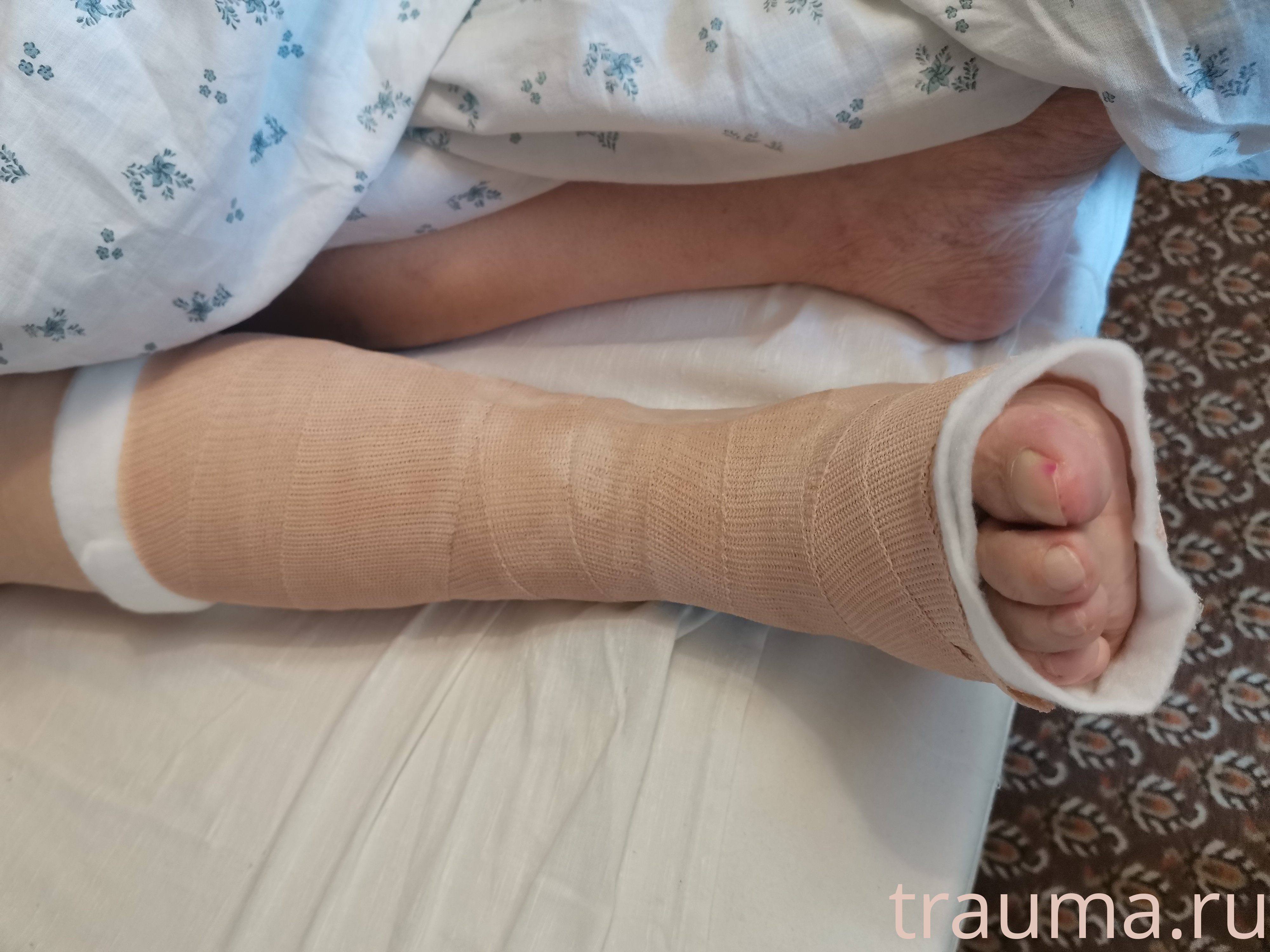 Рентген на дому: по вашему адресу приезжает врач-рентгенолог, травматолог-ортопед с мобильным рентгеновским аппаратом, проводит диагностику травмы или заболевания, делает необходимые рентгенограммы, дает рекомендации по дальнейшему лечению. Получить качественные снимки в домашних условиях возможно благодаря уникальной методике, разработанной МосРентген Центром для института  Склифосовского