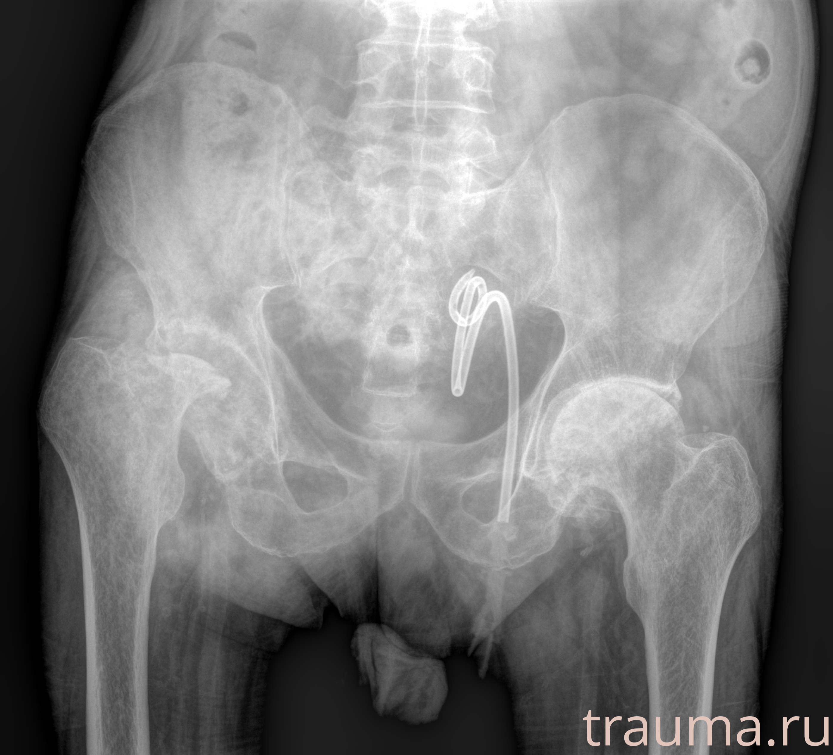 Рентген на дому: по вашему адресу приезжает врач-рентгенолог, травматолог-ортопед с мобильным рентгеновским аппаратом, проводит диагностику травмы или заболевания, делает необходимые рентгенограммы, дает рекомендации по дальнейшему лечению. Получить качественные снимки в домашних условиях возможно благодаря уникальной методике, разработанной МосРентген Центром для института  Склифосовского