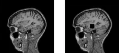 Российские специалисты разработали платформу для генерации синтетических МРТ-снимков