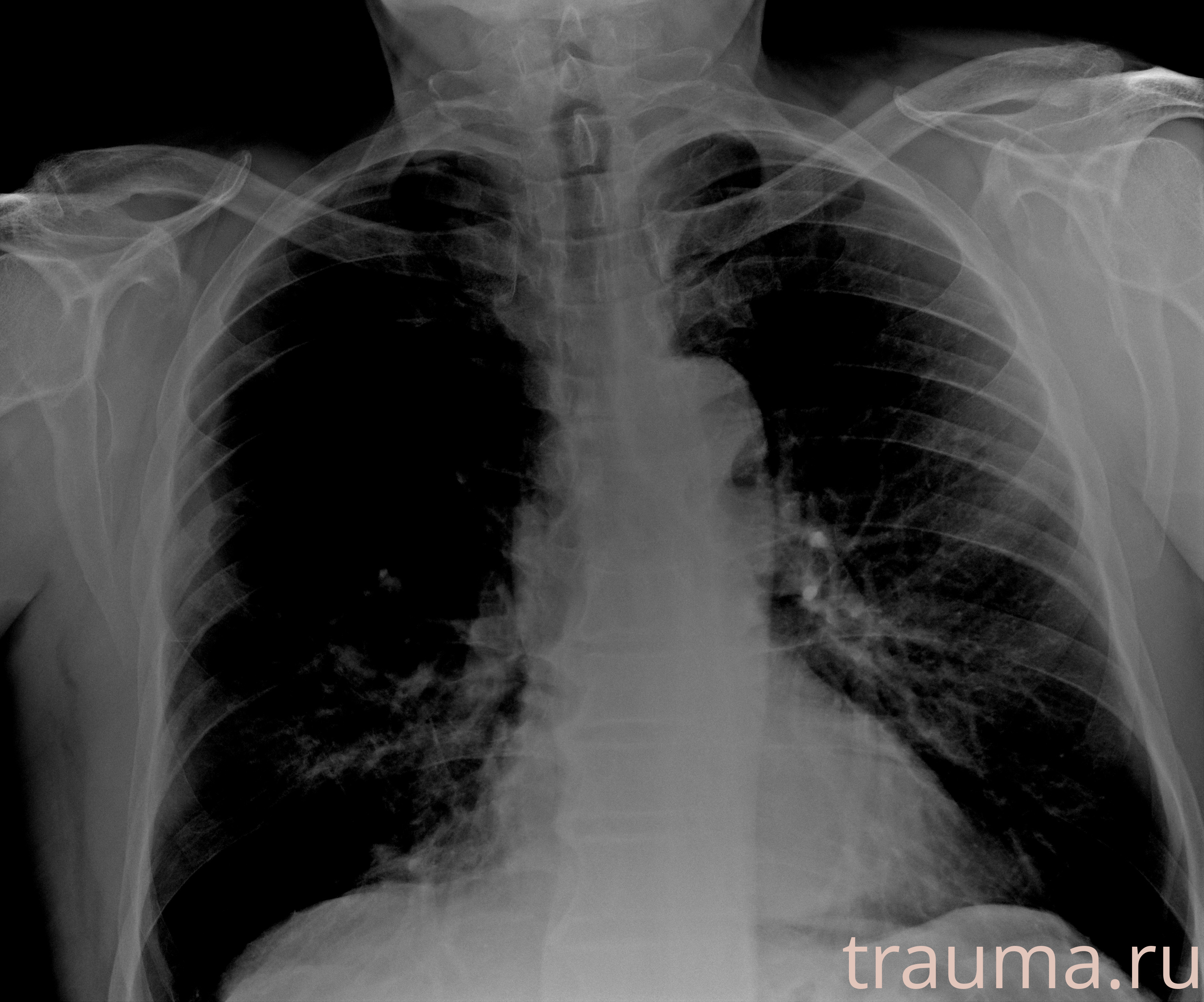 Рентген на дому: по вашему адресу приезжает врач-рентгенолог, травматолог-ортопед с мобильным рентгеновским аппаратом, проводит диагностику травмы или заболевания, делает необходимые рентгенограммы, дает рекомендации по дальнейшему лечению. Получить качественные снимки в домашних условиях возможно благодаря уникальной методике, разработанной МосРентген Центром для института  Склифосовского