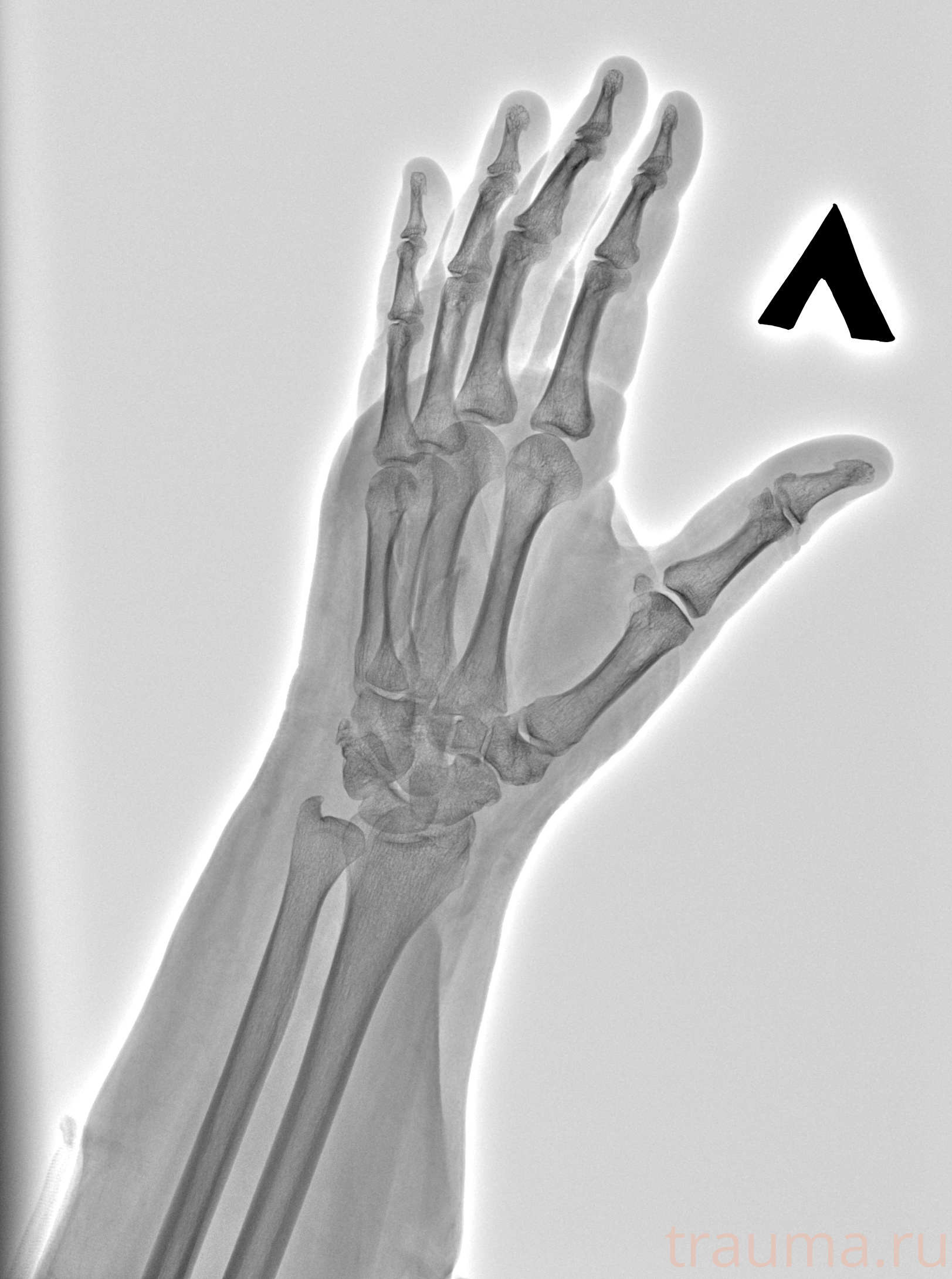 Рентген на дому: по вашему адресу приезжает врач-рентгенолог, травматолог-ортопед с мобильным рентгеновским аппаратом, проводит диагностику травмы или заболевания, делает необходимые рентгенограммы, дает рекомендации по дальнейшему лечению. Получить качественные снимки в домашних условиях возможно благодаря уникальной методике, разработанной МосРентген Центром для института  Склифосовского