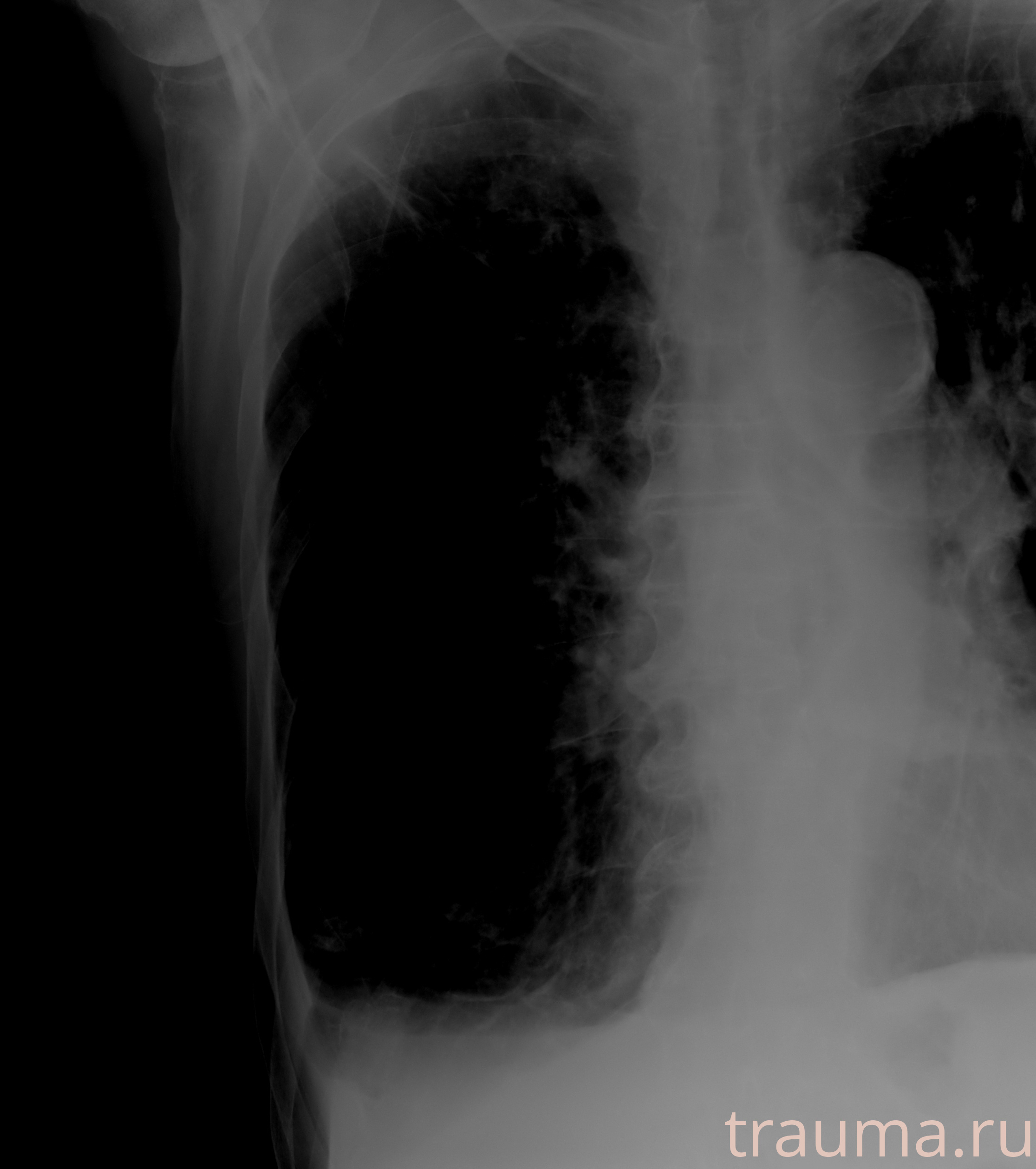 Рентген на дому: по вашему адресу приезжает врач-рентгенолог, травматолог-ортопед с мобильным рентгеновским аппаратом, проводит диагностику травмы или заболевания, делает необходимые рентгенограммы, дает рекомендации по дальнейшему лечению. Получить качественные снимки в домашних условиях возможно благодаря уникальной методике, разработанной МосРентген Центром для института  Склифосовского