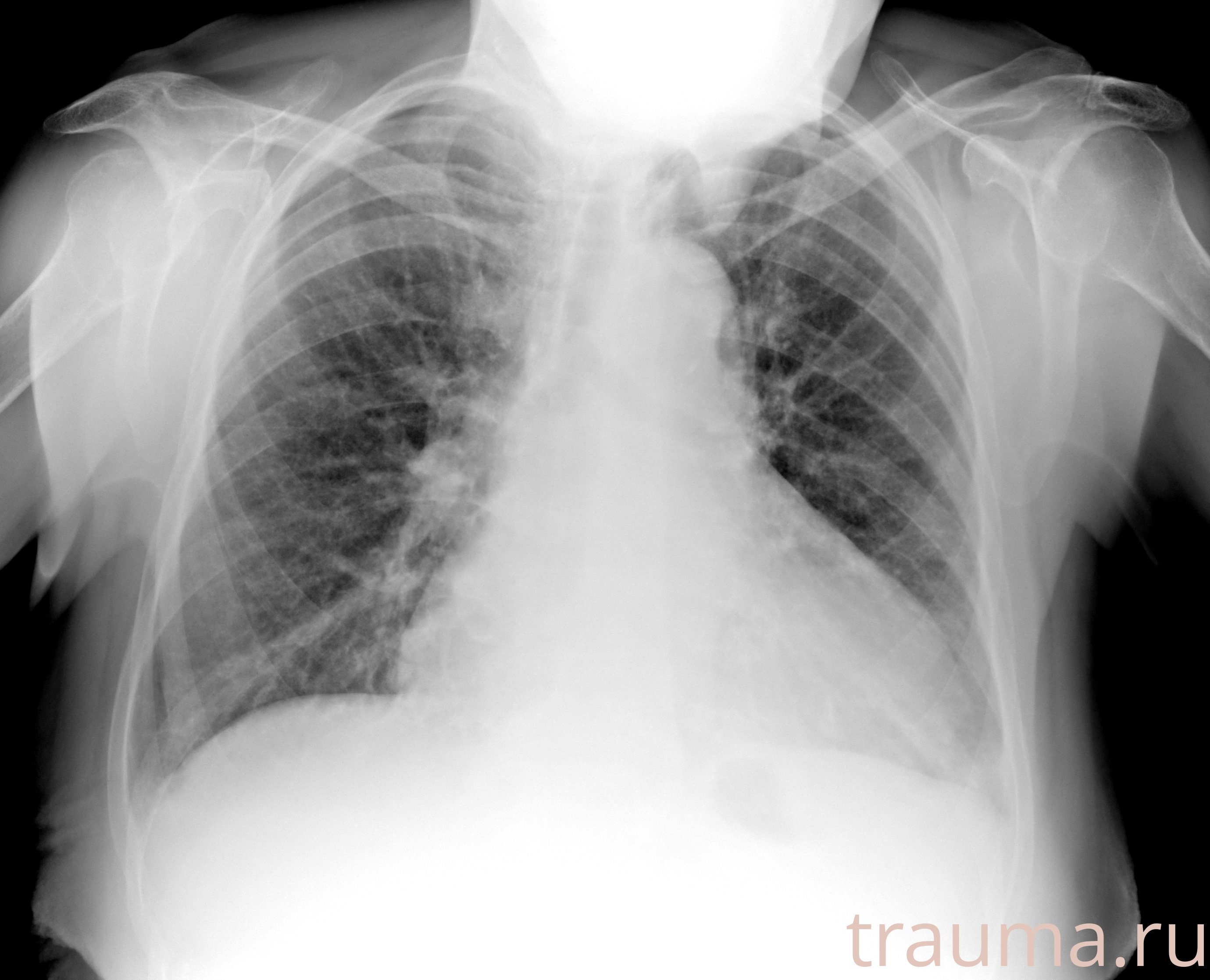 Рентген на дому: по вашему адресу приезжает врач-рентгенолог, травматолог-ортопед с мобильным рентгеновским аппаратом, проводит диагностику травмы или заболевания, делает необходимые рентгенограммы, дает рекомендации по дальнейшему лечению. Получить качественные снимки в домашних условиях возможно благодаря уникальной методике, разработанной МосРентген Центром для института  Склифосовского