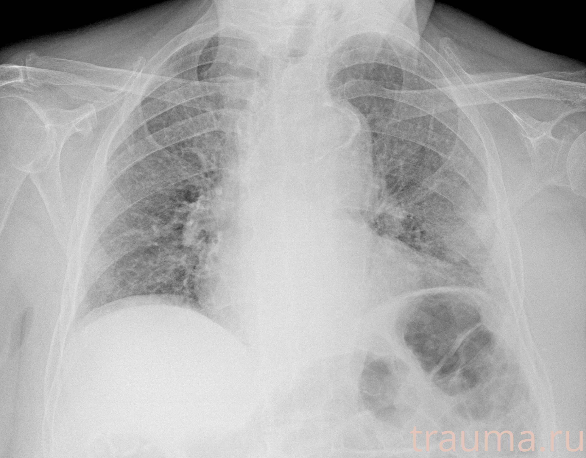 Рентген на дому: по вашему адресу приезжает врач-рентгенолог, травматолог-ортопед с мобильным рентгеновским аппаратом, проводит диагностику травмы или заболевания, делает необходимые рентгенограммы, дает рекомендации по дальнейшему лечению. Получить качественные снимки в домашних условиях возможно благодаря уникальной методике, разработанной МосРентген Центром для института  Склифосовского