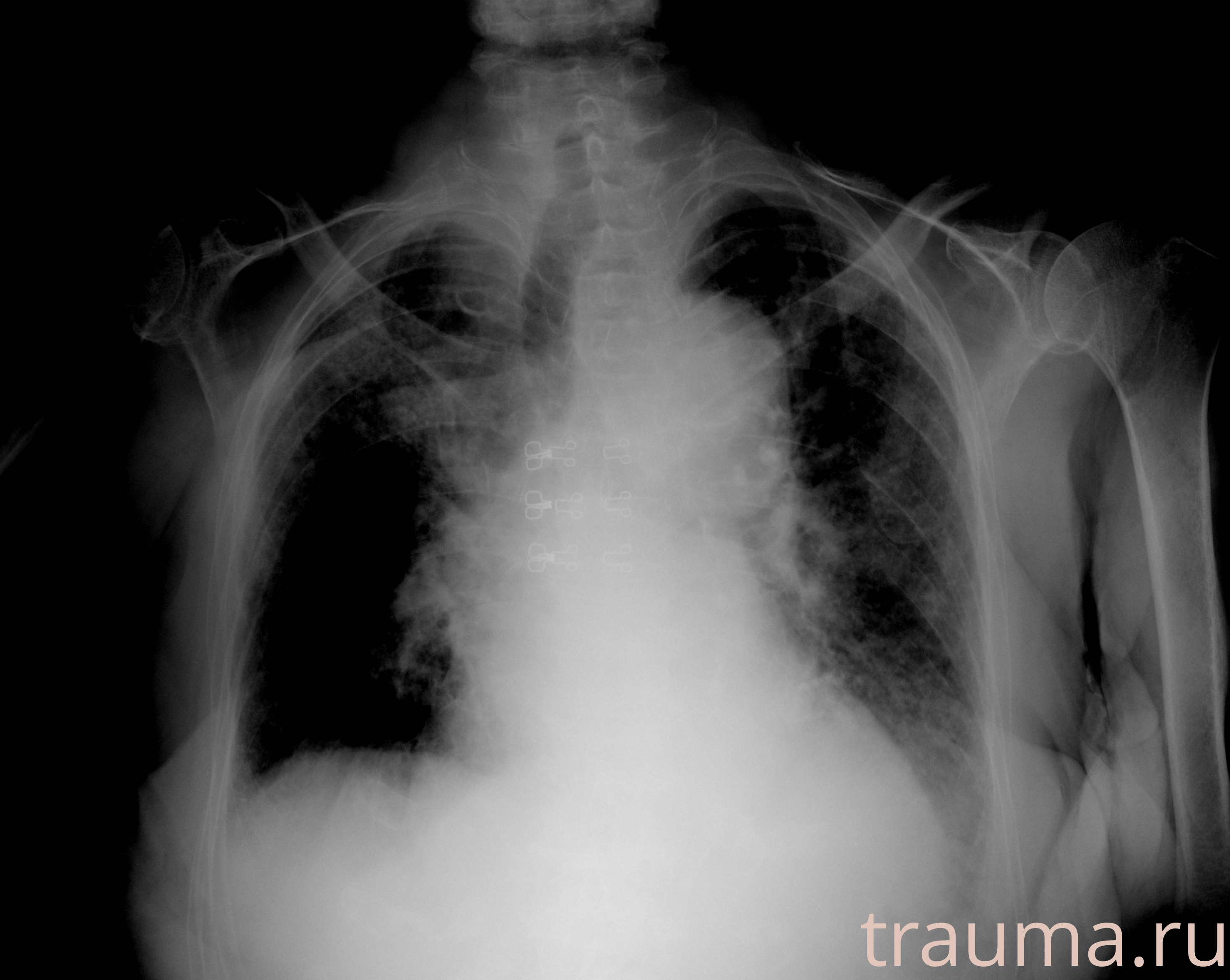 Рентген на дому: по вашему адресу приезжает врач-рентгенолог, травматолог-ортопед с мобильным рентгеновским аппаратом, проводит диагностику травмы или заболевания, делает необходимые рентгенограммы, дает рекомендации по дальнейшему лечению. Получить качественные снимки в домашних условиях возможно благодаря уникальной методике, разработанной МосРентген Центром для института  Склифосовского