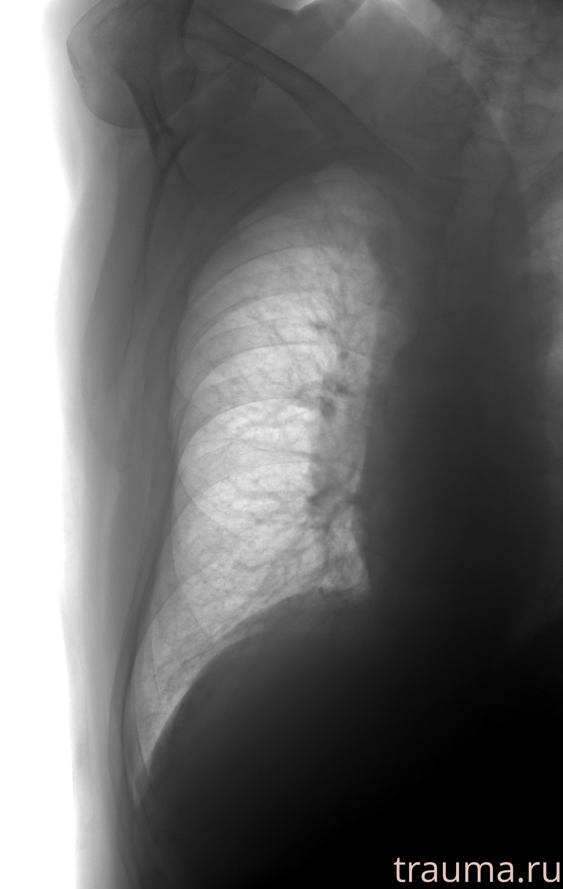 Рентген на дому: по вашему адресу приезжает врач-рентгенолог, травматолог-ортопед с мобильным рентгеновским аппаратом, проводит диагностику травмы или заболевания, делает необходимые рентгенограммы, дает рекомендации по дальнейшему лечению. Получить качественные снимки в домашних условиях возможно благодаря уникальной методике, разработанной МосРентген Центром для института  Склифосовского