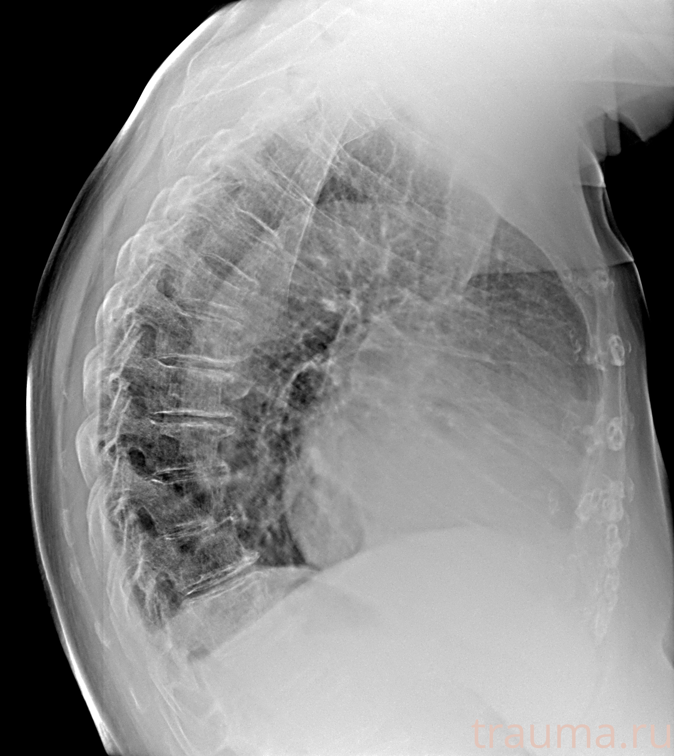 Рентген на дому: по вашему адресу приезжает врач-рентгенолог, травматолог-ортопед с мобильным рентгеновским аппаратом, проводит диагностику травмы или заболевания, делает необходимые рентгенограммы, дает рекомендации по дальнейшему лечению. Получить качественные снимки в домашних условиях возможно благодаря уникальной методике, разработанной МосРентген Центром для института  Склифосовского