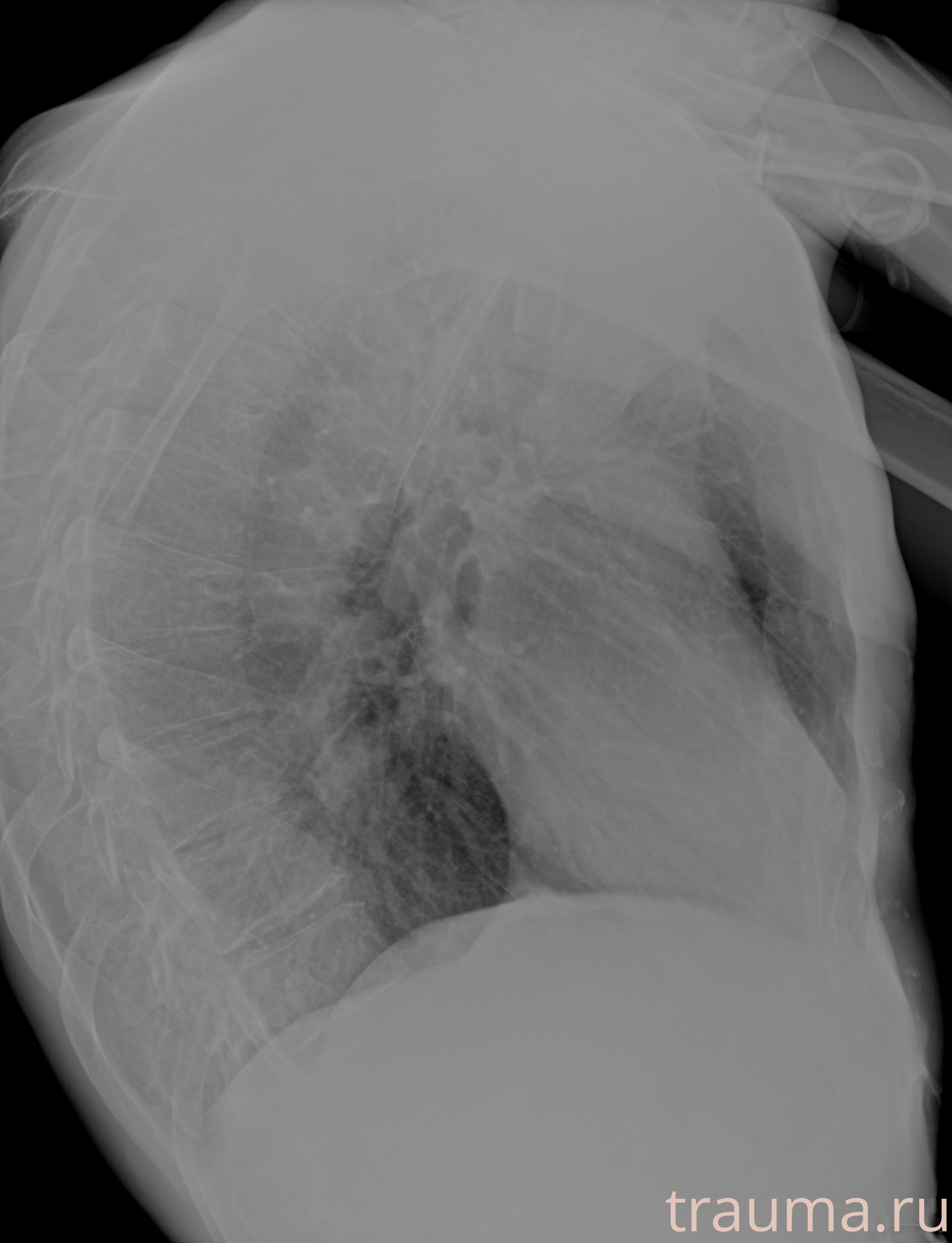 Рентген на дому: по вашему адресу приезжает врач-рентгенолог, травматолог-ортопед с мобильным рентгеновским аппаратом, проводит диагностику травмы или заболевания, делает необходимые рентгенограммы, дает рекомендации по дальнейшему лечению. Получить качественные снимки в домашних условиях возможно благодаря уникальной методике, разработанной МосРентген Центром для института  Склифосовского