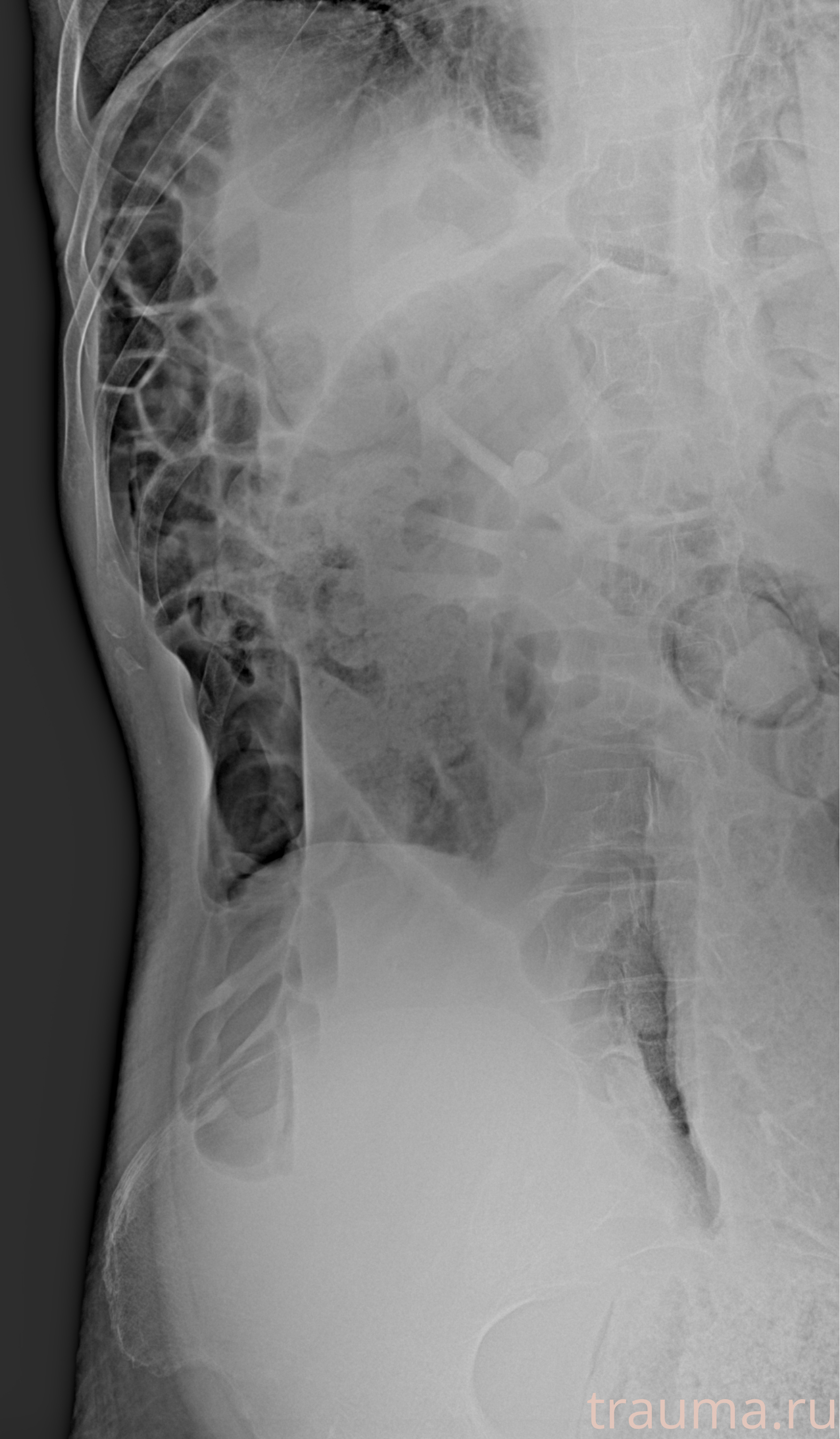 Рентген на дому: по вашему адресу приезжает врач-рентгенолог, травматолог-ортопед с мобильным рентгеновским аппаратом, проводит диагностику травмы или заболевания, делает необходимые рентгенограммы, дает рекомендации по дальнейшему лечению. Получить качественные снимки в домашних условиях возможно благодаря уникальной методике, разработанной МосРентген Центром для института  Склифосовского
