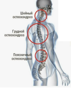 Оценка качества работы искусственного интеллекта в выявлении дегенеративных заболеваний пояснично-крестцового отдела позвоночника Оценка качества работы искусственного интеллекта в выявлении дегенеративных заболеваний пояснично-крестцового отдела позвоночника