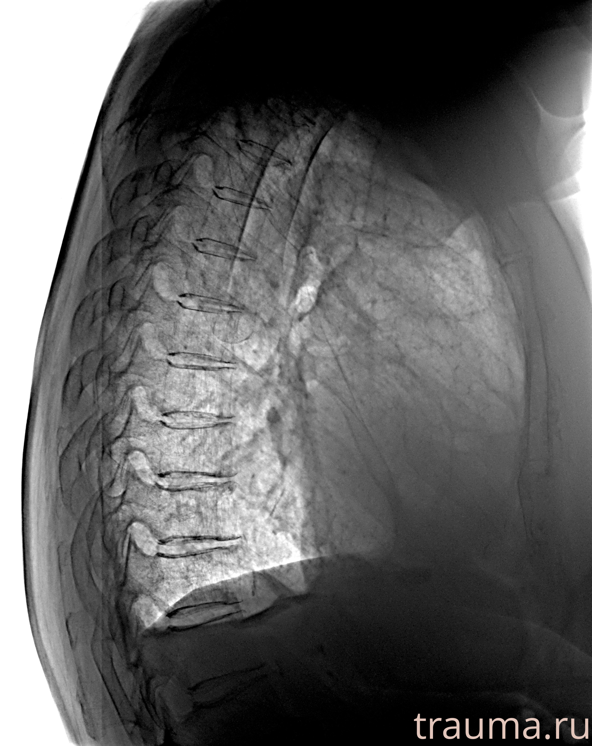 Рентген на дому: по вашему адресу приезжает врач-рентгенолог, травматолог-ортопед с мобильным рентгеновским аппаратом, проводит диагностику травмы или заболевания, делает необходимые рентгенограммы, дает рекомендации по дальнейшему лечению. Получить качественные снимки в домашних условиях возможно благодаря уникальной методике, разработанной МосРентген Центром для института  Склифосовского