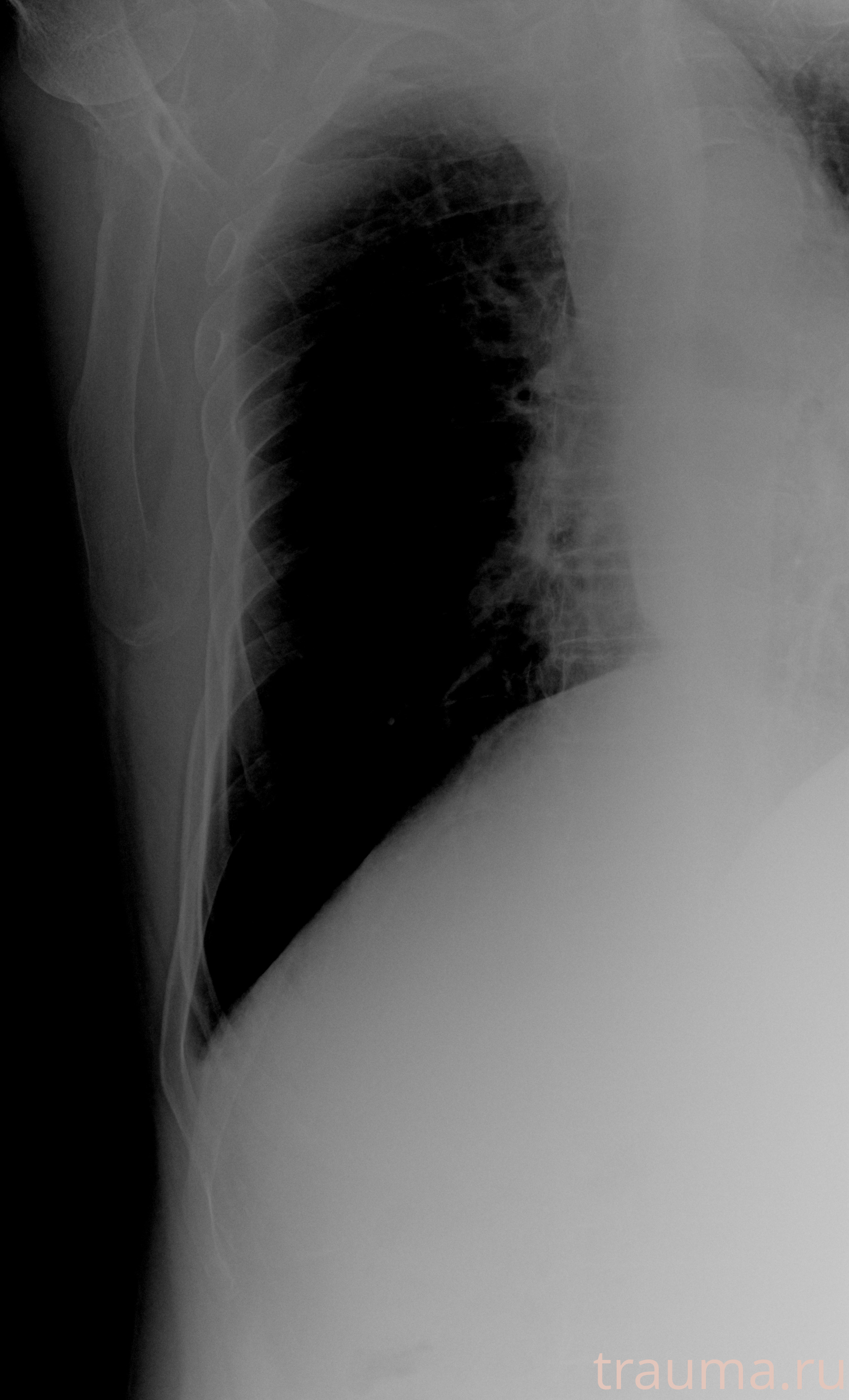 Рентген на дому: по вашему адресу приезжает врач-рентгенолог, травматолог-ортопед с мобильным рентгеновским аппаратом, проводит диагностику травмы или заболевания, делает необходимые рентгенограммы, дает рекомендации по дальнейшему лечению. Получить качественные снимки в домашних условиях возможно благодаря уникальной методике, разработанной МосРентген Центром для института  Склифосовского