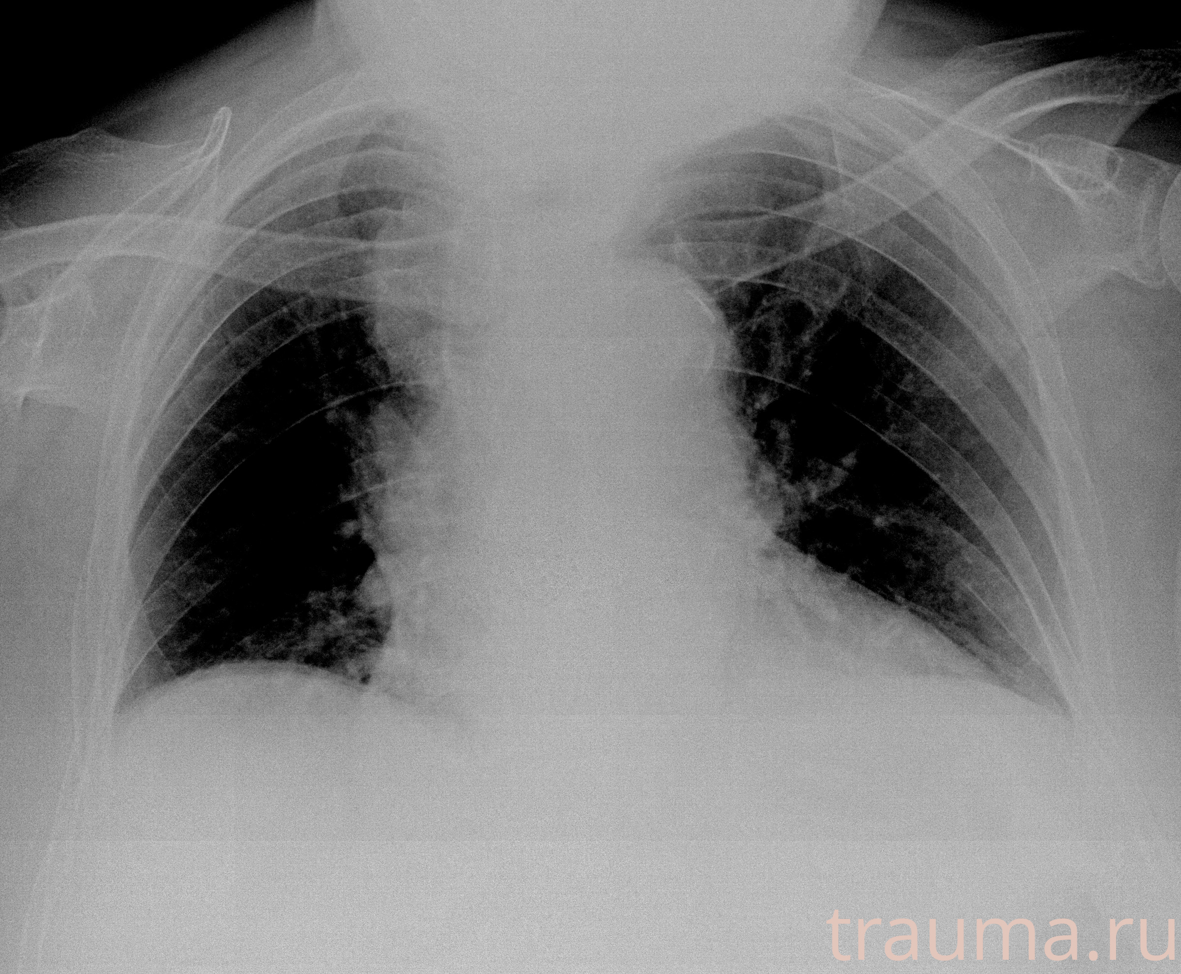 Рентген на дому: по вашему адресу приезжает врач-рентгенолог, травматолог-ортопед с мобильным рентгеновским аппаратом, проводит диагностику травмы или заболевания, делает необходимые рентгенограммы, дает рекомендации по дальнейшему лечению. Получить качественные снимки в домашних условиях возможно благодаря уникальной методике, разработанной МосРентген Центром для института  Склифосовского