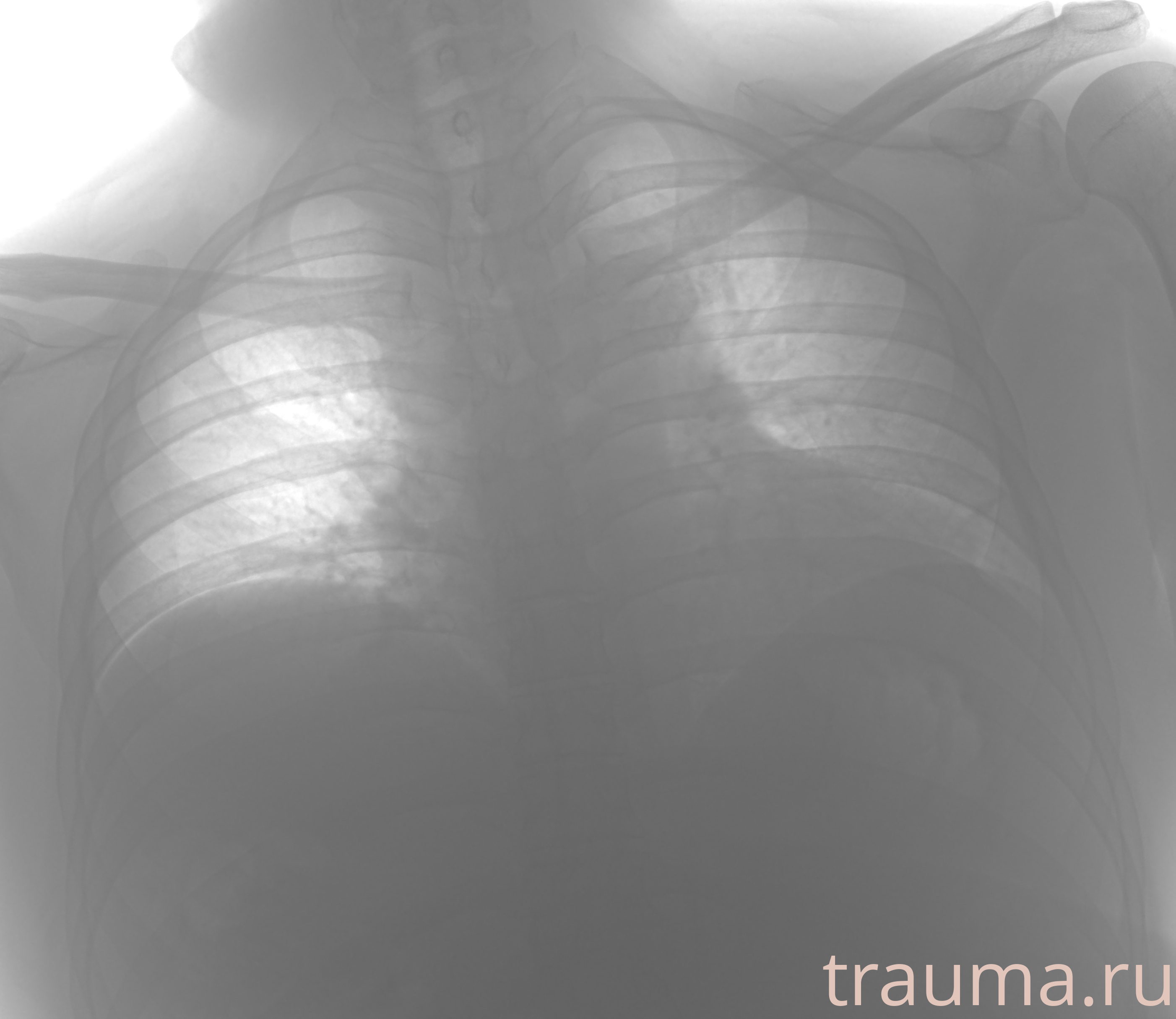 Рентген на дому: по вашему адресу приезжает врач-рентгенолог, травматолог-ортопед с мобильным рентгеновским аппаратом, проводит диагностику травмы или заболевания, делает необходимые рентгенограммы, дает рекомендации по дальнейшему лечению. Получить качественные снимки в домашних условиях возможно благодаря уникальной методике, разработанной МосРентген Центром для института  Склифосовского