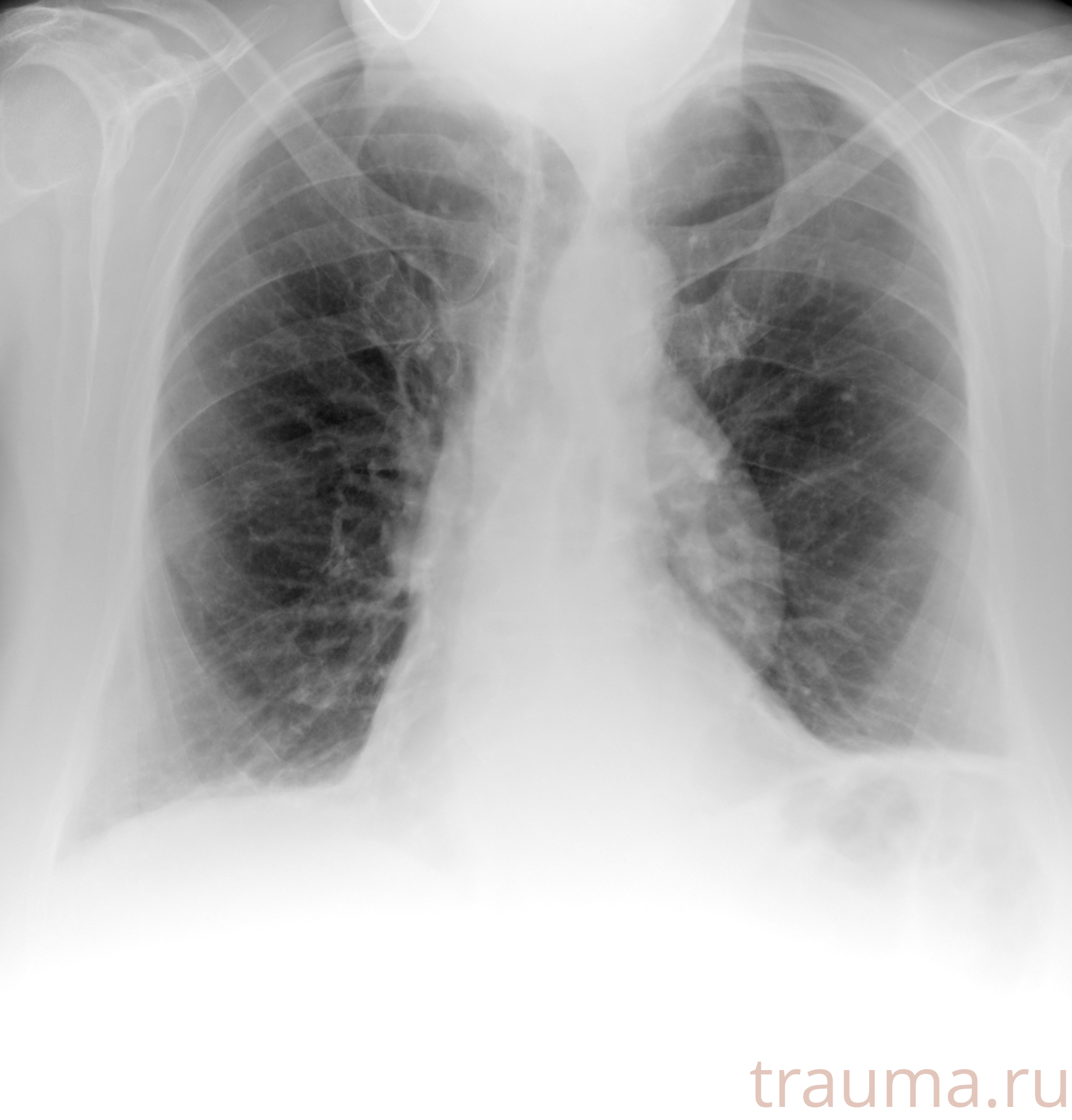 Рентген на дому: по вашему адресу приезжает врач-рентгенолог, травматолог-ортопед с мобильным рентгеновским аппаратом, проводит диагностику травмы или заболевания, делает необходимые рентгенограммы, дает рекомендации по дальнейшему лечению. Получить качественные снимки в домашних условиях возможно благодаря уникальной методике, разработанной МосРентген Центром для института  Склифосовского