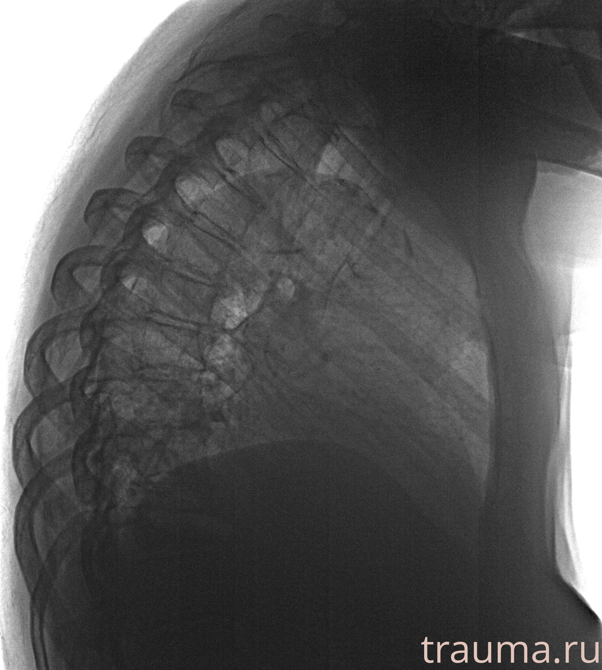 Рентген на дому: по вашему адресу приезжает врач-рентгенолог, травматолог-ортопед с мобильным рентгеновским аппаратом, проводит диагностику травмы или заболевания, делает необходимые рентгенограммы, дает рекомендации по дальнейшему лечению. Получить качественные снимки в домашних условиях возможно благодаря уникальной методике, разработанной МосРентген Центром для института  Склифосовского