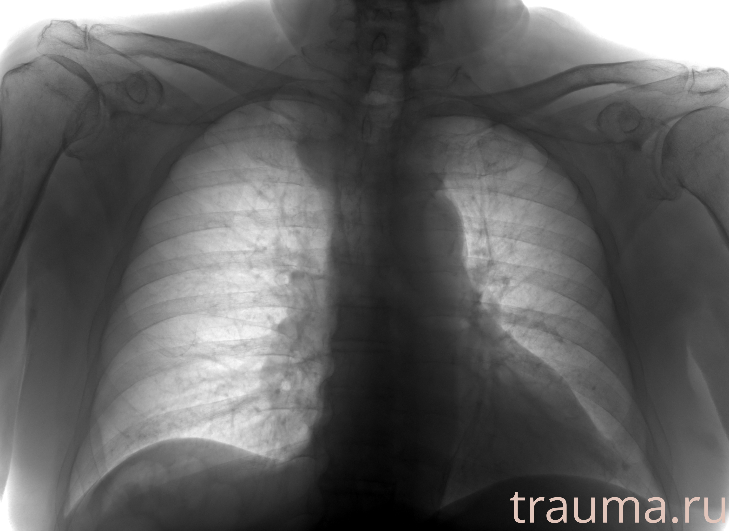 Рентген на дому: по вашему адресу приезжает врач-рентгенолог, травматолог-ортопед с мобильным рентгеновским аппаратом, проводит диагностику травмы или заболевания, делает необходимые рентгенограммы, дает рекомендации по дальнейшему лечению. Получить качественные снимки в домашних условиях возможно благодаря уникальной методике, разработанной МосРентген Центром для института  Склифосовского