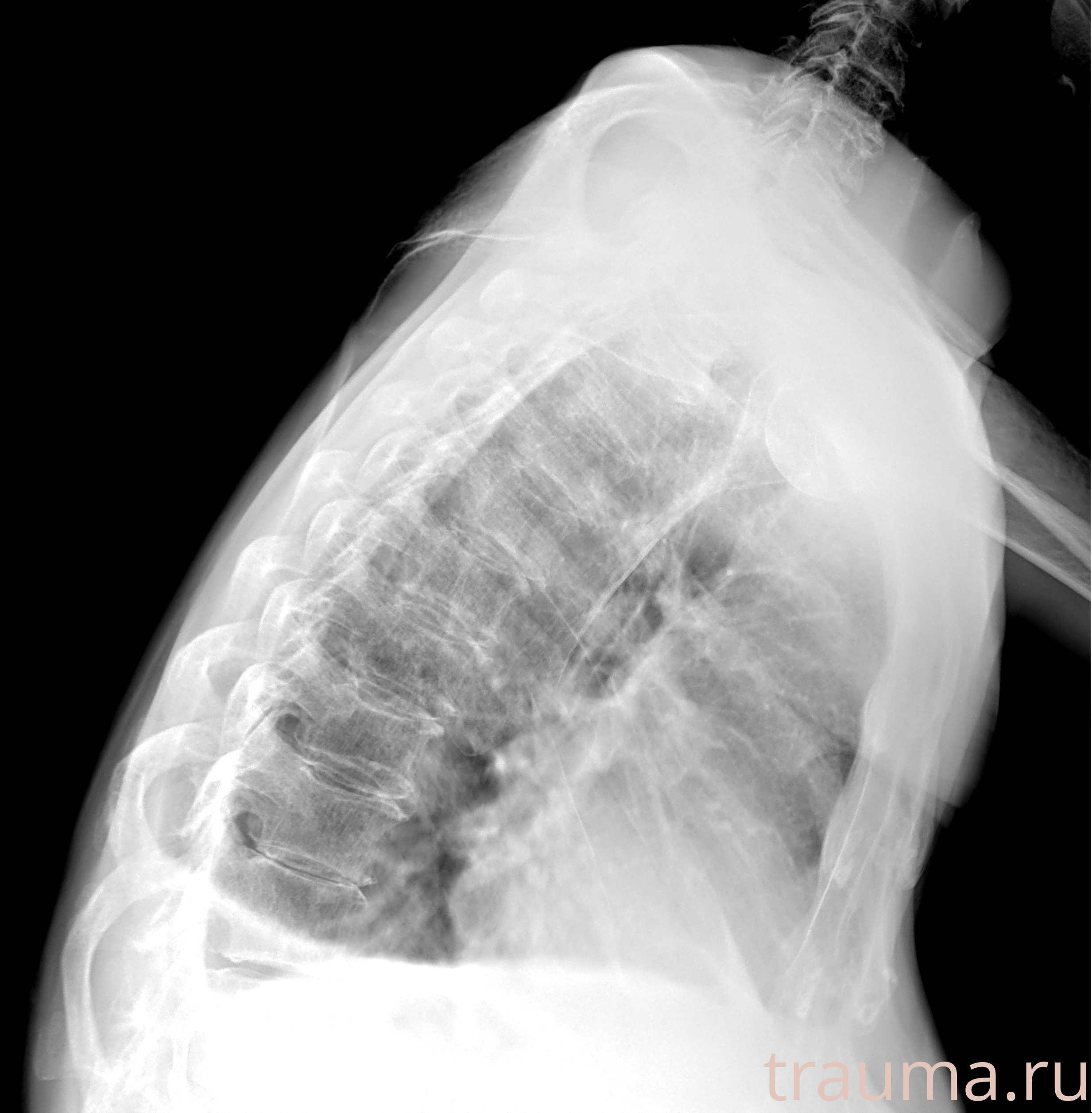 Рентген на дому: по вашему адресу приезжает врач-рентгенолог, травматолог-ортопед с мобильным рентгеновским аппаратом, проводит диагностику травмы или заболевания, делает необходимые рентгенограммы, дает рекомендации по дальнейшему лечению. Получить качественные снимки в домашних условиях возможно благодаря уникальной методике, разработанной МосРентген Центром для института  Склифосовского