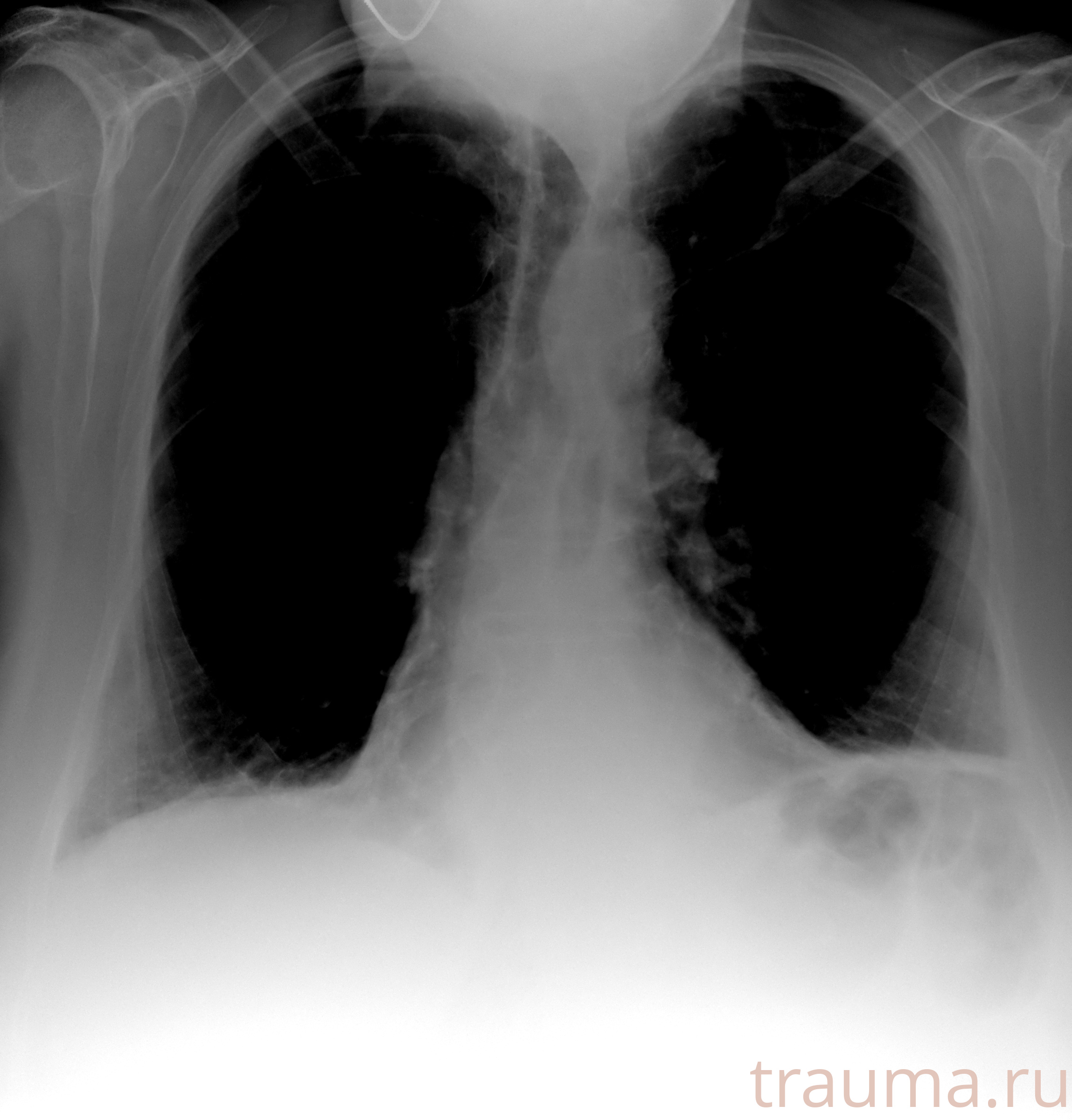 Рентген на дому: по вашему адресу приезжает врач-рентгенолог, травматолог-ортопед с мобильным рентгеновским аппаратом, проводит диагностику травмы или заболевания, делает необходимые рентгенограммы, дает рекомендации по дальнейшему лечению. Получить качественные снимки в домашних условиях возможно благодаря уникальной методике, разработанной МосРентген Центром для института  Склифосовского