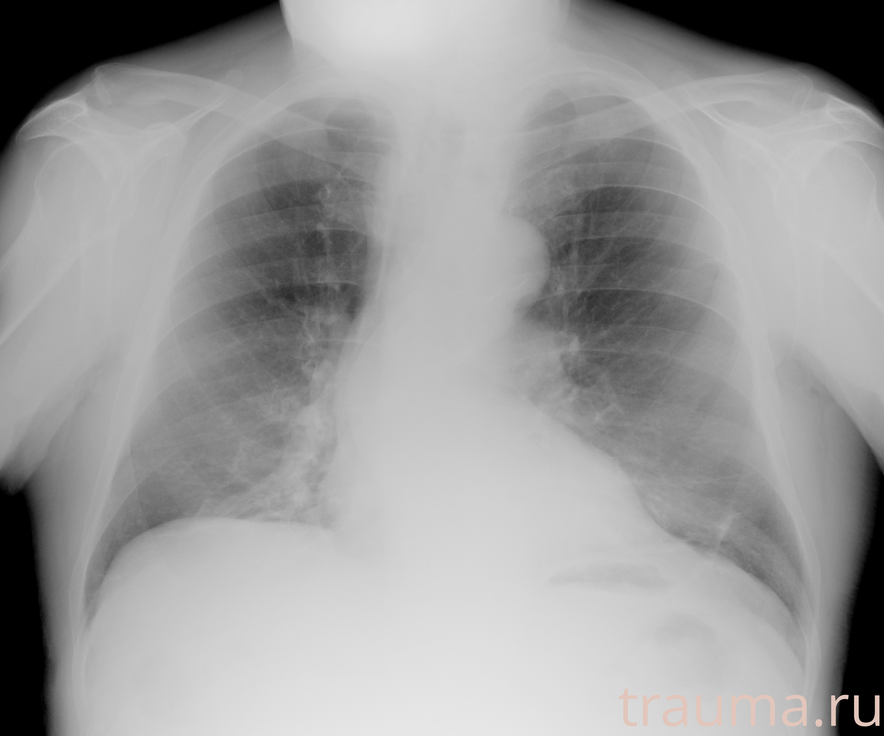 Рентген на дому: по вашему адресу приезжает врач-рентгенолог, травматолог-ортопед с мобильным рентгеновским аппаратом, проводит диагностику травмы или заболевания, делает необходимые рентгенограммы, дает рекомендации по дальнейшему лечению. Получить качественные снимки в домашних условиях возможно благодаря уникальной методике, разработанной МосРентген Центром для института  Склифосовского