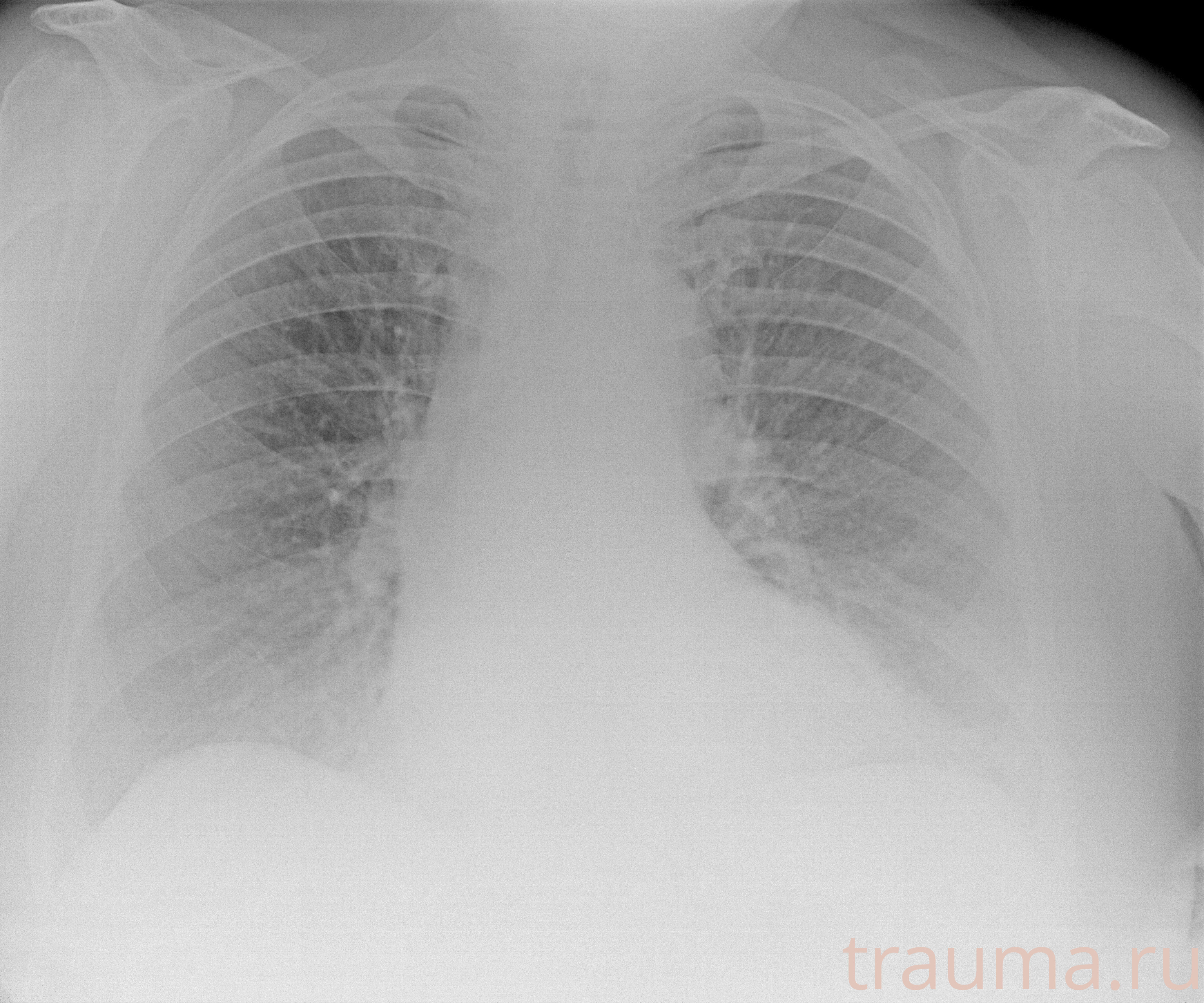 Рентген на дому: по вашему адресу приезжает врач-рентгенолог, травматолог-ортопед с мобильным рентгеновским аппаратом, проводит диагностику травмы или заболевания, делает необходимые рентгенограммы, дает рекомендации по дальнейшему лечению. Получить качественные снимки в домашних условиях возможно благодаря уникальной методике, разработанной МосРентген Центром для института  Склифосовского