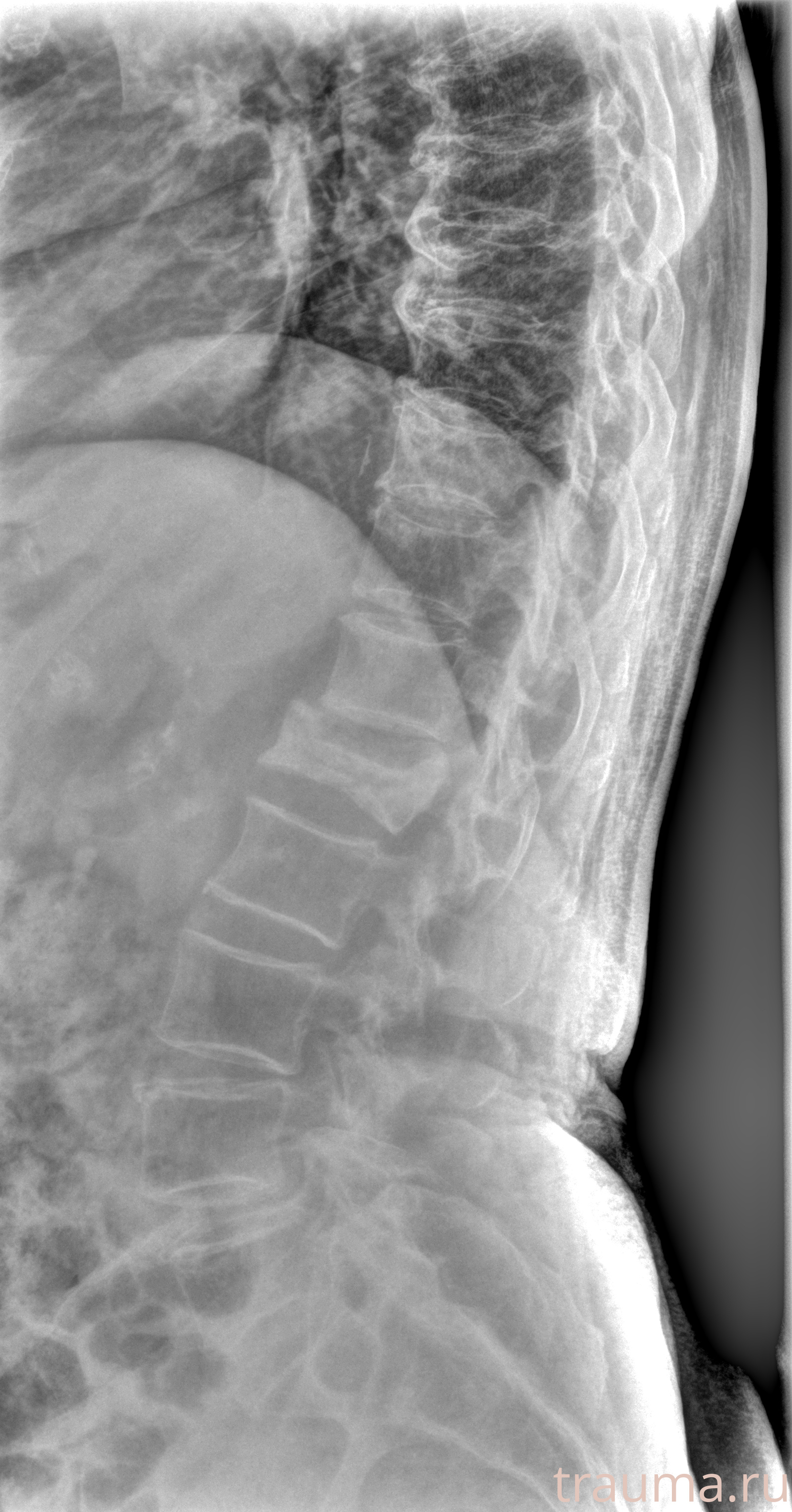Рентген на дому: по вашему адресу приезжает врач-рентгенолог, травматолог-ортопед с мобильным рентгеновским аппаратом, проводит диагностику травмы или заболевания, делает необходимые рентгенограммы, дает рекомендации по дальнейшему лечению. Получить качественные снимки в домашних условиях возможно благодаря уникальной методике, разработанной МосРентген Центром для института  Склифосовского