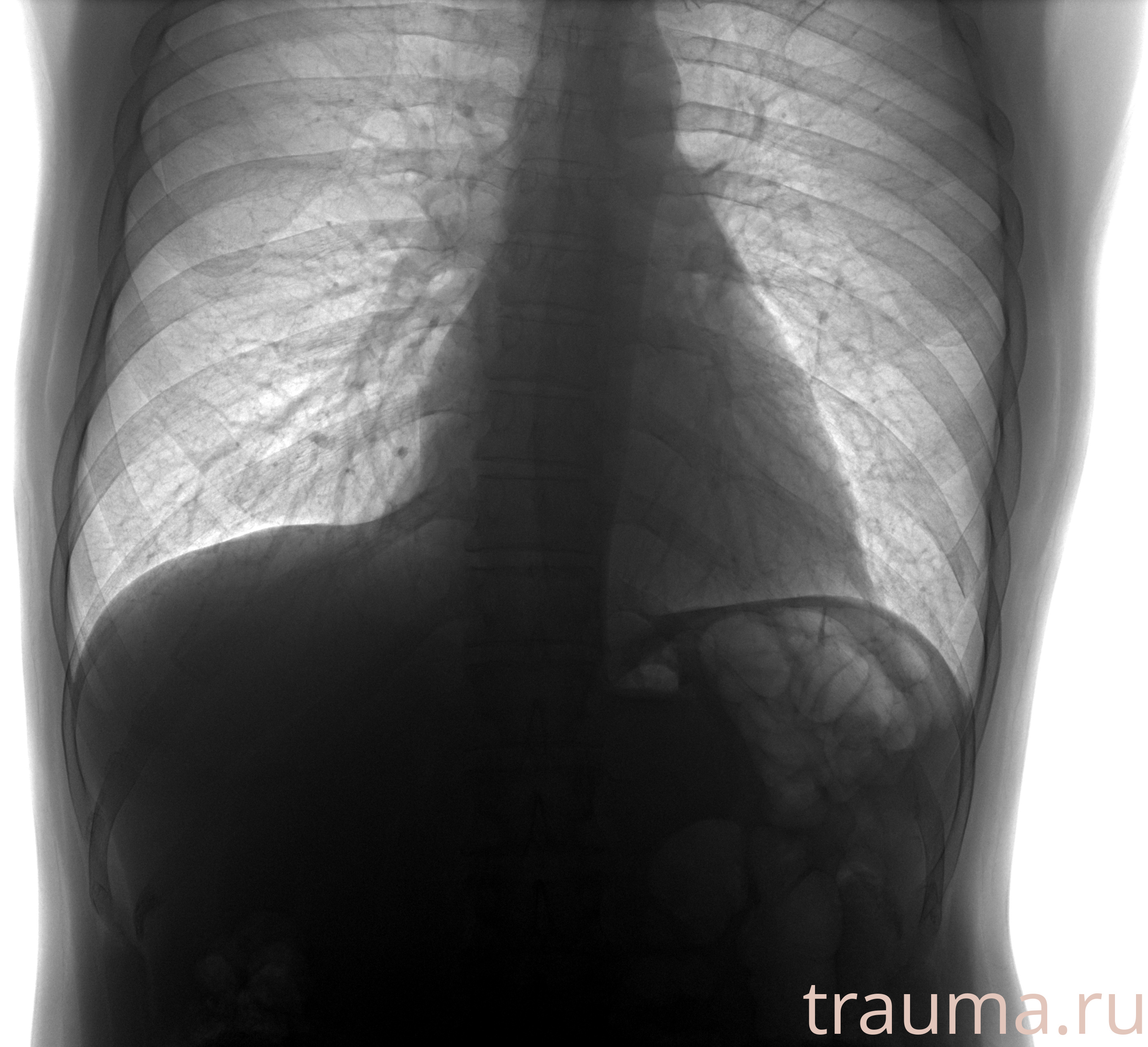 Рентген на дому: по вашему адресу приезжает врач-рентгенолог, травматолог-ортопед с мобильным рентгеновским аппаратом, проводит диагностику травмы или заболевания, делает необходимые рентгенограммы, дает рекомендации по дальнейшему лечению. Получить качественные снимки в домашних условиях возможно благодаря уникальной методике, разработанной МосРентген Центром для института  Склифосовского