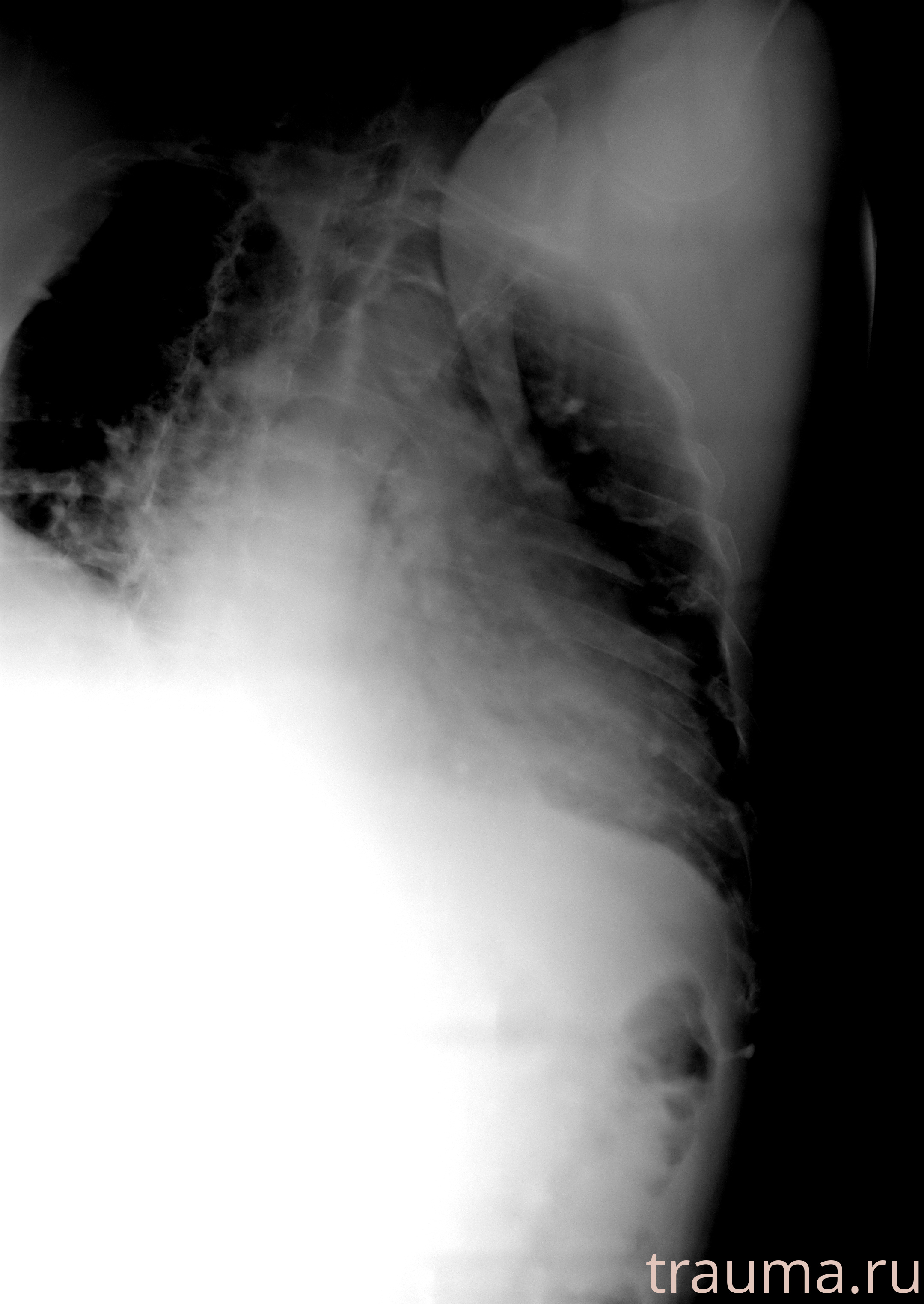 Рентген на дому: по вашему адресу приезжает врач-рентгенолог, травматолог-ортопед с мобильным рентгеновским аппаратом, проводит диагностику травмы или заболевания, делает необходимые рентгенограммы, дает рекомендации по дальнейшему лечению. Получить качественные снимки в домашних условиях возможно благодаря уникальной методике, разработанной МосРентген Центром для института  Склифосовского