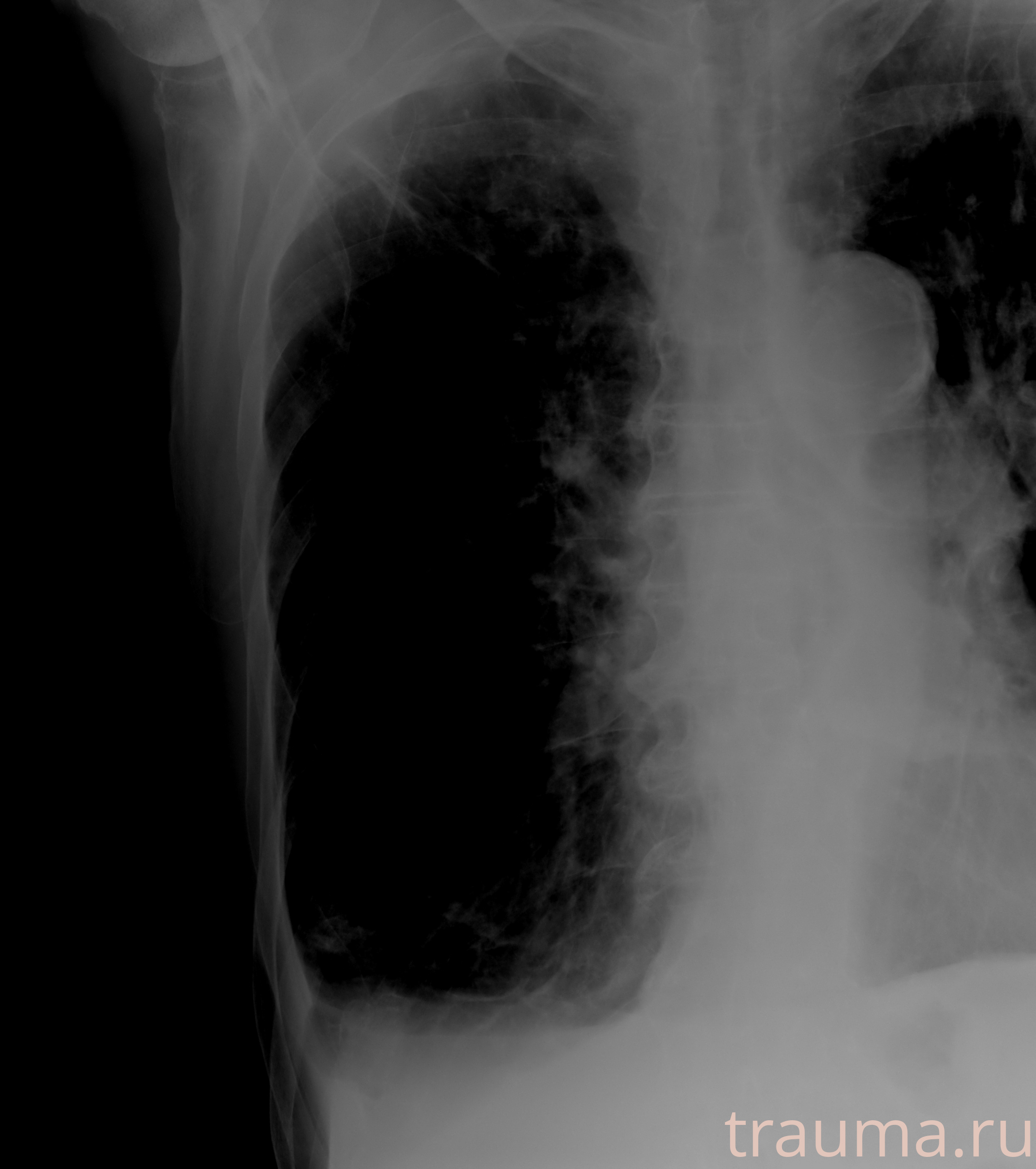 Рентген на дому: по вашему адресу приезжает врач-рентгенолог, травматолог-ортопед с мобильным рентгеновским аппаратом, проводит диагностику травмы или заболевания, делает необходимые рентгенограммы, дает рекомендации по дальнейшему лечению. Получить качественные снимки в домашних условиях возможно благодаря уникальной методике, разработанной МосРентген Центром для института  Склифосовского